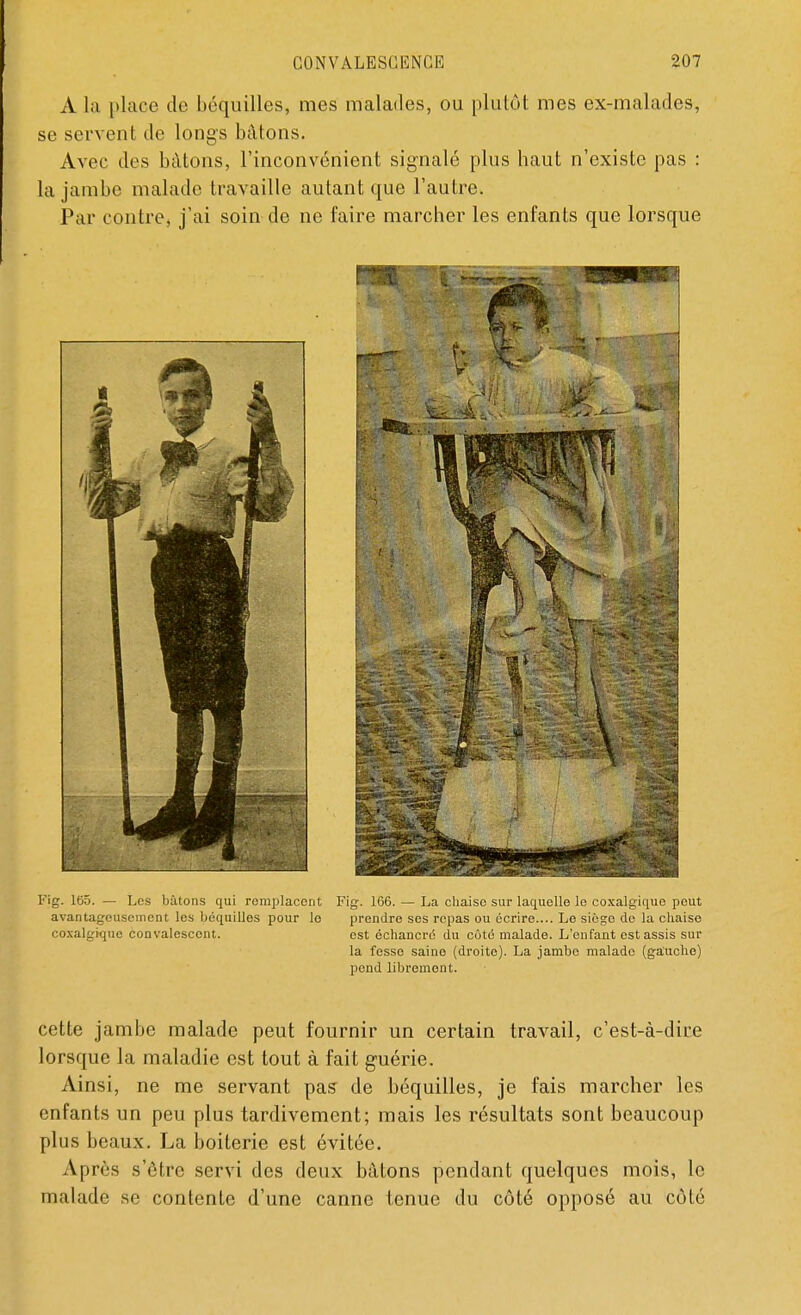 A la place do béquilles, mes malades, ou plutôt mes ex-malades, se servent de longs bâtons. Avec des bâtons, l'inconvénient signalé plus haut n'existe pas : la jambe malade travaille autant que l'autre. Par contre, j'ai soin de ne faire marcher les enfants que lorsque Kig. 165. — Les bâtons qui remplacent Fig. 166. — La chaise sur laquelle le coxalgique peut avantageusement les béquilles pour le prendre ses repas ou écrire.... Le siège de la chaise coxalgique convalescent. est échancré du côté malade. L'enfant est assis sur la fesse saine (droito). La jambe malade (gauche) pend librement. cette jambe malade peut fournir un certain travail, c'est-à-dire lorsque la maladie est tout à fait guérie. Ainsi, ne me servant pas de béquilles, je fais marcher les enfants un peu plus tardivement; mais les résultats sont beaucoup plus beaux. La boiterie est évitée. Après s'être servi des deux bâtons pendant quelques mois, le malade se contente d'une canne tenue du côté opposé au côté