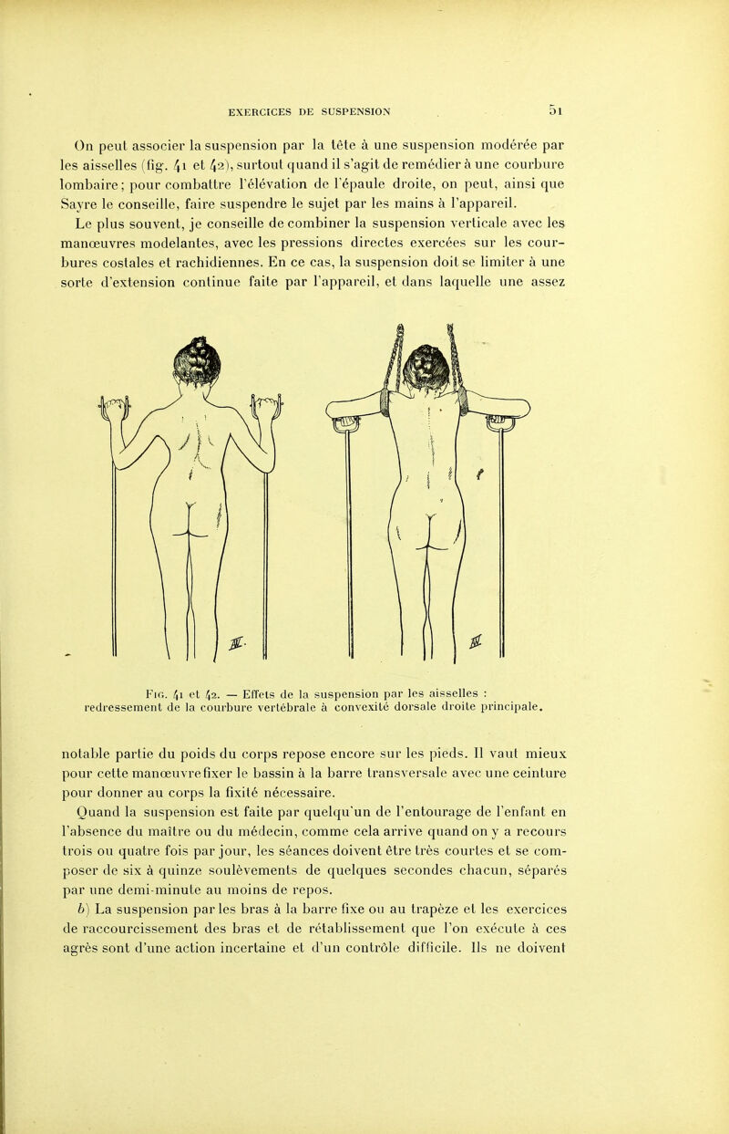 On peut associer la suspension par la tête à une suspension modérée par les aisselles (fig. 4i et 42), surtout quand il s'agit de remédier à une courbure lombaire ; pour combattre l'élévation de Tépaule droite, on peut, ainsi que Sayre le conseille, faire suspendre le sujet par les mains à l'appareil. Le plus souvent, je conseille de combiner la suspension verticale avec les manœuvres modelantes, avec les pressions directes exercées sur les cour- bures costales et rachidiennes. En ce cas, la suspension doit se limiter à une sorte d'extension continue faite par l'appareil, et dans laquelle une assez FiG. 41 et 42. — Effets de la suspension par les aisselles : redressement de la courbure vertébrale à convexité dorsale droite principale. notable partie du poids du corps repose encore sur les pieds. Il vaut mieux pour cette manœuvreflxer le bassin à la barre transversale avec une ceinture pour donner au corps la fixité nécessaire. Quand la suspension est faite par quelqu'un de l'entourage de l'enfant en l'absence du maître ou du médecin, comme cela arrive quand on y a recours trois ou quatre fois par jour, les séances doivent être très courtes et se com- poser de six à quinze soulèvements de quelques secondes chacun, séparés par une demi-minute au moins de repos. 6) La suspension par les bras à la barre fixe ou au trapèze et les exercices de raccourcissement des bras et de rétablissement que l'on exécute à ces agrès sont d'une action incertaine et d'un contrôle difficile. Ils ne doivent