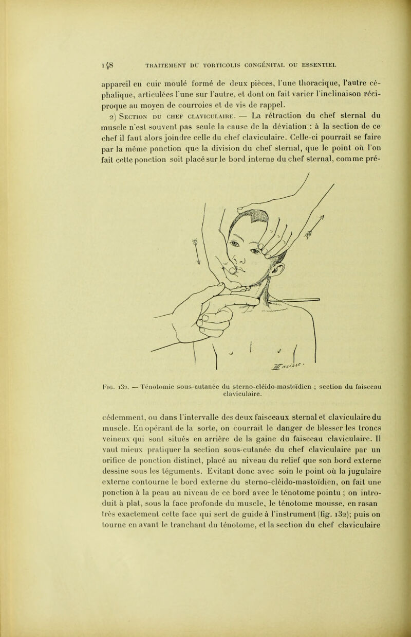 appareil en cuir moulé formé de deux pièces, l'une thoracique, l'autre cé- phalique, articulées l une sur l'autre, et dont on fait varier l'inclinaison réci- proque au moyen de courroies et de vis de rappel. 2) Section du chef claviculaire. — La rétraction du chef sternal du muscle n'est souvent pas seule la cause de la déviation : à la section de ce chef il faut alors joindre celle du chef claviculaire. Celle-ci pourrait se faire par la même ponction que la division du chef sternal, que le point où l'on fait cette ponction soit placé sur le bord interne du chef sternal, comme pré- FiG. i32. — Téliolomie sous-culanée du sterno-cléido-mastoïdien ; section du faisceau claviculaire. cédemmenl, ou dans l'intervalle des deux faisceaux sternal et claviculaire du muscle. En opérant de la sorte, on courrait le danger de blesser les troncs veineux qui sont situés en arrière de la gaine du faisceau claviculaire. Il vaut mieux pratiquer la section sous-cutanée du chef claviculaire par un orifice de ponction distinct, placé au niveau du relief que son bord externe dessine sous les téguments. Evitant donc avec soin le point où la jugulaire externe contourne le bord externe du sterno-cléido-mastoïdien, on fait une ponction à la peau au niveau de ce bord avec le ténolome pointu ; on intro- duit à plat, sous la face profonde du muscle, le ténotome mousse, en rasan Irès exactement celte face qui sert de guide à l'instrument (fig. 182); puis on tourne en avant le tranchant du ténotome, et la section du chef claviculaire