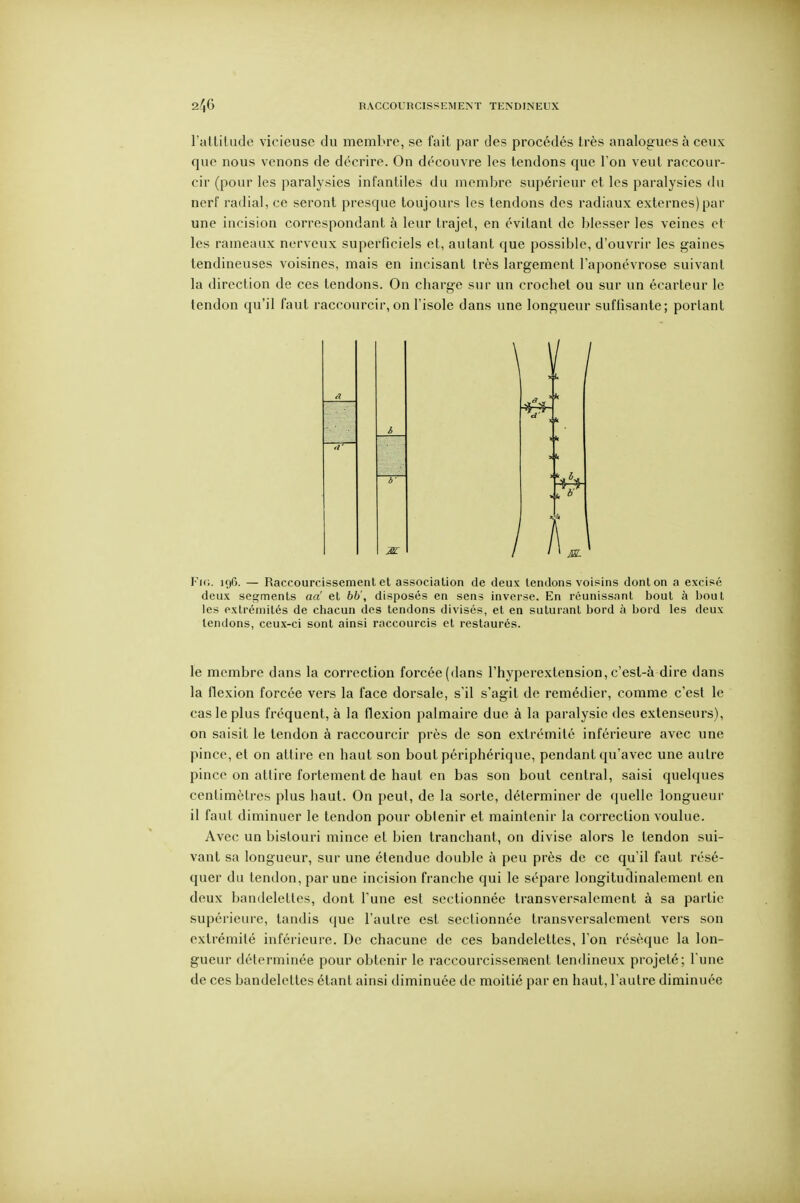 l'altitude vicieuse du membre, se fait par des procédés très analogues à ceux que nous venons de décrire. On découvre les tendons que l'on veut raccour- cir (pour les paralysies infantiles du membre supérieur et les paralysies du nerf radial, ce seront presque toujours les tendons des radiaux externes) par une incision correspondant à leur trajet, en évitant de blesser les veines et les rameaux nerveux superficiels et, autant que possible, d'ouvrir les gaines tendineuses voisines, mais en incisant très largement l'aponévrose suivant la direction de ces tendons. On charge sur un crochet ou sur un écarteur le tendon qu'il faut raccourcir, on l'isole dans une longueur suffisante; portant M Fk;. i()6. — Raccourcissement et association de deux tendons voisins dont on a excisé deux segments ad et 66', disposés en sens inverse. En réunissant bout à bout les extrémités de chacun des tendons divisés, et en suturant bord à bord les deux tendons, ceux-ci sont ainsi raccourcis et restaurés. le membre dans la correction forcée (dans l'hyperextension, c'esl-à dire dans la flexion forcée vers la face dorsale, s'il s'agit de remédier, comme c'est le cas le plus fréquent, à la flexion palmaire due à la paralysie des extenseurs), on saisit le tendon à raccourcir près de son extrémité inférieure avec une pince, et on attii-e en haut son bout périphérique, pendant qu'avec une autre pince on attire fortement de haut en bas sou bout central, saisi quelques centimètres plus haut. On peut, de la sorte, déterminer de (juelle longueur il faut diminuer le tendon pour obtenir et maintenir la correction voulue. Avec un bistouri mince et bien tranchant, on divise alors le tendon sui- vant sa longueur, sur une étendue double à peu près de ce qu'il faut résé- quer du tendon, par une incision franche qui le sépare longitudinalement en deux bandelettes, dont l'une est sectionnée transversalement à sa partie supérieure, tandis que l'autre est sectionnée transversalement vers son extrémité inférieure. De chacune de ces bandelettes, l'on résèque la lon- gueur déterminée pour obtenir le raccourcissement tendineux projeté; l'une de ces bandelettes étant ainsi diminuée de moitié par en haut, l'autre diminuée