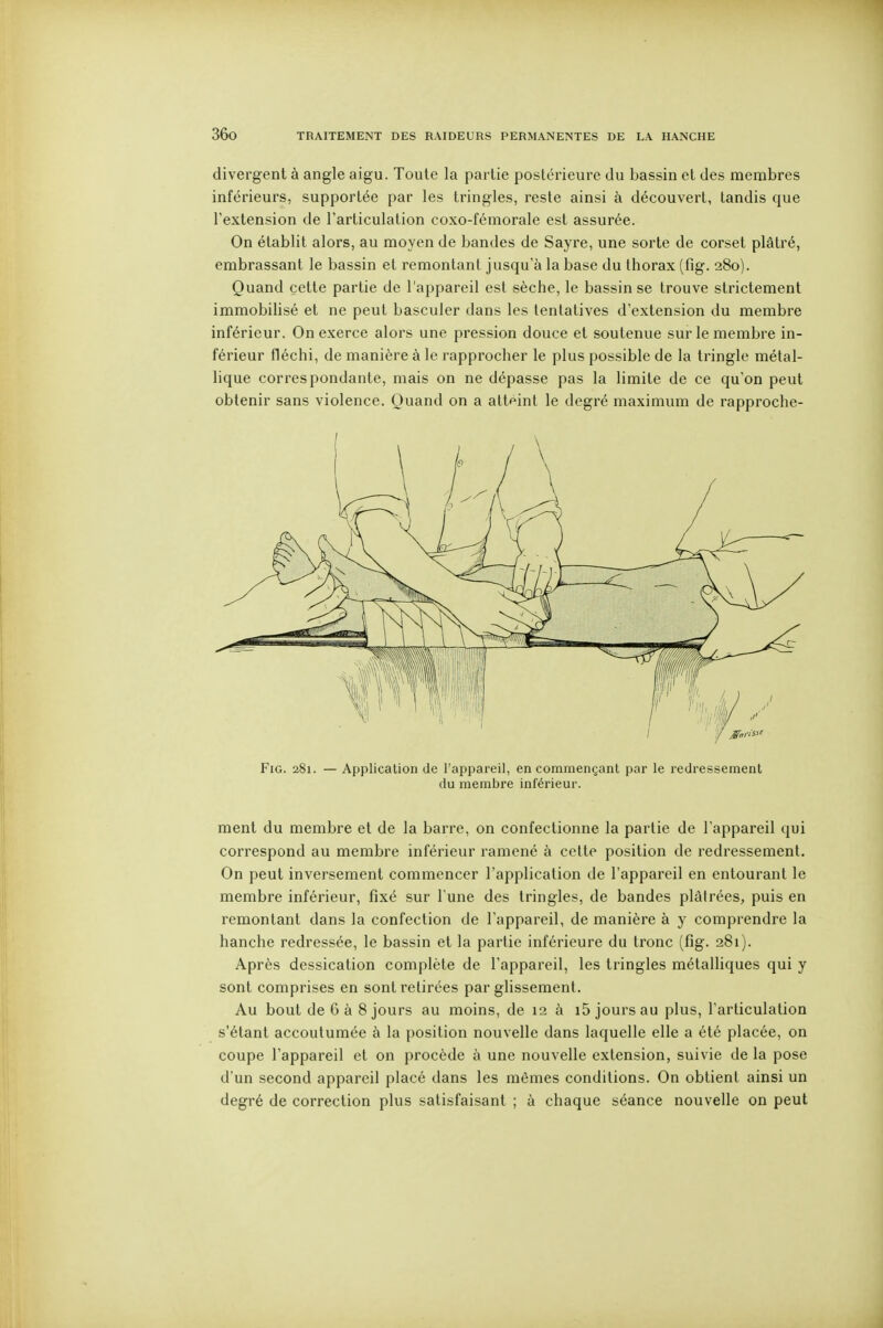 divergent à angle aigu. Toute la partie postérieure du bassin et des membres inférieurs, supportée par les tringles, reste ainsi à découvert, tandis que l'extension de l'articulation coxo-fémorale est assurée. On établit alors, au moyen de bandes de Sayre, une sorte de corset plâtré, embrassant le bassin et remontant jusqu'à la base du thorax (fig. 280). Quand cette partie de l'appareil est sèche, le bassin se trouve strictement immobihsé et ne peut basculer dans les tentatives d'extension du membre inférieur. On exerce alors une pression douce et soutenue sur le membre in- férieur fléchi, de manière à le rapprocher le plus possible de la tringle métal- lique correspondante, mais on ne dépasse pas la limite de ce qu'on peut obtenir sans violence. Quand on a attf»int le degré maximum de rapproche- FiG. 281. — Application de l'appareil, en commençant par le redressement du membre inférieur. ment du membre et de la barre, on confectionne la partie de l'appareil qui correspond au membre inférieur ramené à cette position de redressement. On peut inversement commencer l'application de l'appareil en entourant le membre inférieur, fixé sur l une des tringles, de bandes plâtrées, puis en remontant dans la confection de l'appareil, de manière à y comprendre la hanche redressée, le bassin et la partie inférieure du tronc (fig. 281). Après dessication complète de l'appareil, les tringles métalliques qui y sont comprises en sont retirées par glissement. Au bout de 6 à 8 jours au moins, de 12 à i5 jours au plus, l'articulation s'étant accoutumée à la position nouvelle dans laquelle elle a été placée, on coupe l'appareil et on procède à une nouvelle extension, suivie de la pose d'un second appareil placé dans les mêmes conditions. On obtient ainsi un degré de correction plus satisfaisant ; à chaque séance nouvelle on peut