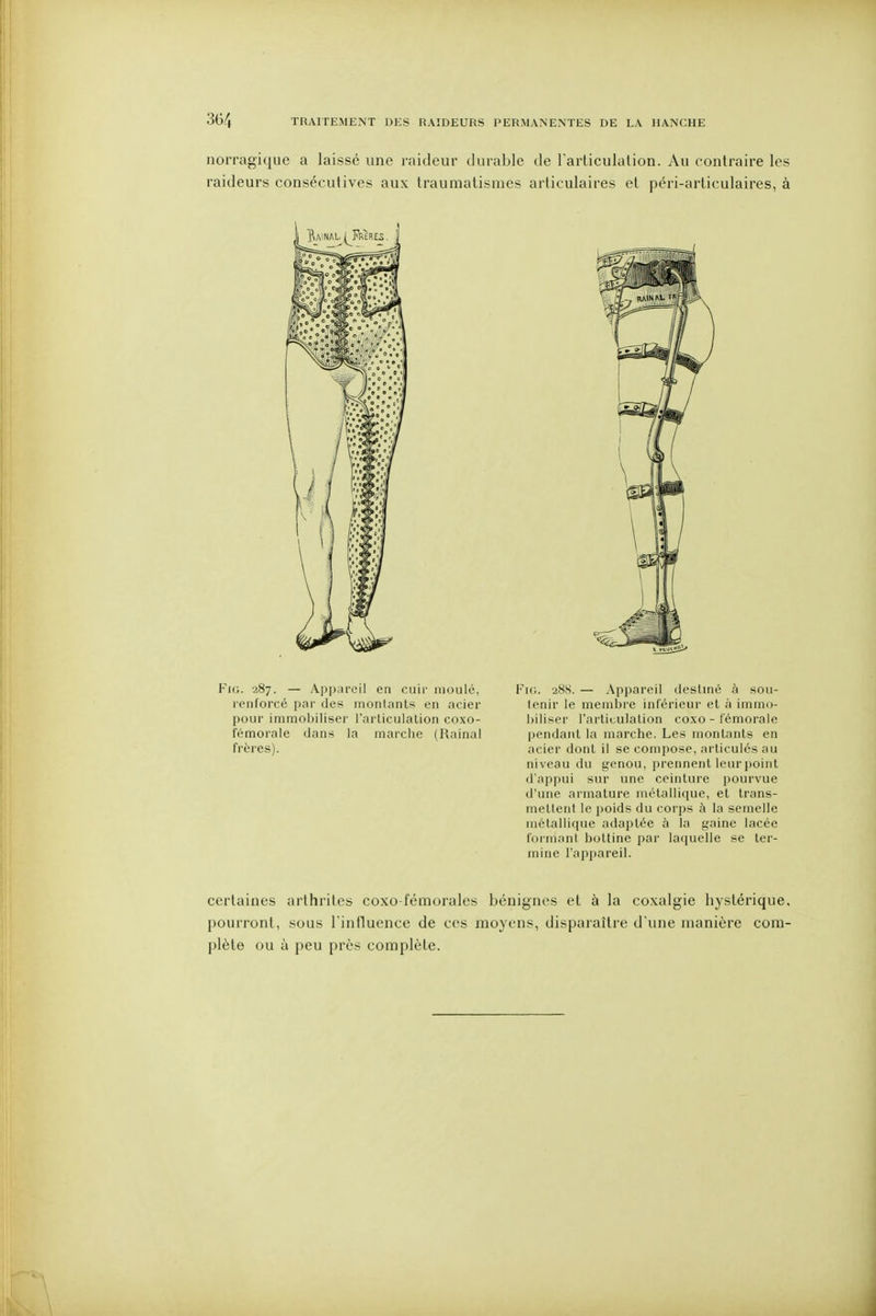 norragique a laissé une raideur durable de Tarticulalion. Au contraire les raideurs consécutives aux Iraumalismes articulaires et péri-articulaires, à FiG. 287. — Appareil en cuir moulé, renforcé par des montants en acier pour immobiliser l'articulation coxo- fémorale dans la marciie (Rainai frères). FiG. -288. — Appareil tiestmé à sou- tenir le membre inférieur et à immo- biliser l'articulation coxo - fémorale pendant la marche. Les montants en acier dont il se compose, articulés au niveau du genou, prennent leur point d'appui sur une ceinture pourvue d'une armature métallique, et trans- mettent le i)oids du corps à la semelle rnétalli(|ue adaptée ù la gaine lacée formanl bottine par laquelle se ter- mine l'appareil. certaines arthrites coxo-léinorales bénignes et à la coxalgie hystérique, pourront, sous riniluence de ces moyens, disparaître d'une manière com- plète ou ù peu près complète.