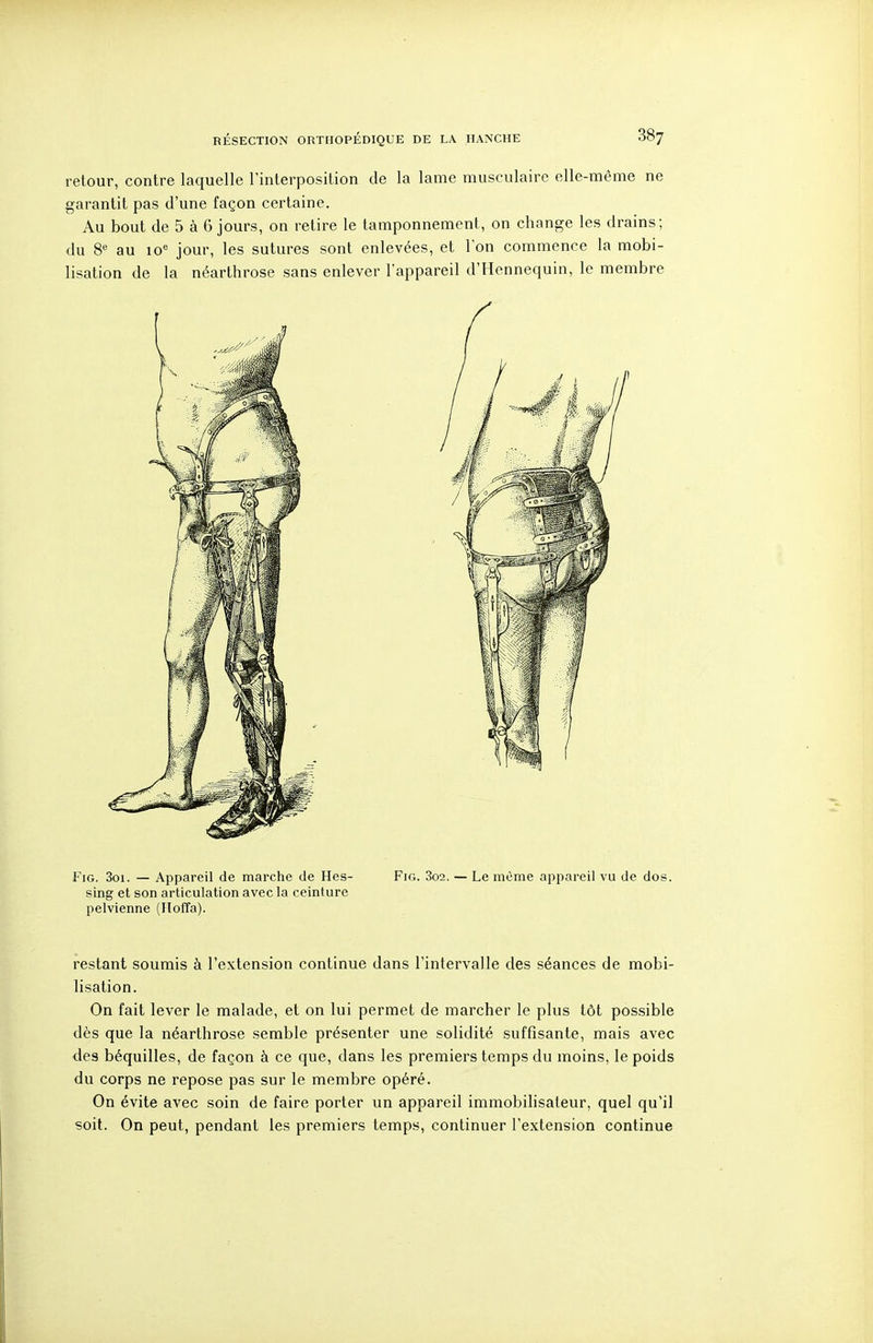 retour, contre laquelle l'interposition de la lame musculaire elle-même ne garantit pas d'une façon certaine. Au bout de 5 à 6 jours, on retire le tamponnement, on change les drains; du 8^ au 10® jour, les sutures sont enlevées, et l'on commence la mobi- lisation de la néarthrose sans enlever l'appareil d'Hennequin, le membre FiG. 3oi. — Appareil de marche de Hes- Fig. 3o2. — Le même appareil vu de dos. sing et son articulation avec la ceinture pelvienne (IToffa). restant soumis à l'extension continue dans l'intervalle des séances de mobi- lisation. On fait lever le malade, et on lui permet de marcher le plus tôt possible dès que la néarthrose semble présenter une solidité suffisante, mais avec des béquilles, de façon à ce que, dans les premiers temps du moins, le poids du corps ne repose pas sur le membre opéré. On évite avec soin de faire porter un appareil immobilisateur, quel qu'il soit. On peut, pendant les premiers temps, continuer l'extension continue