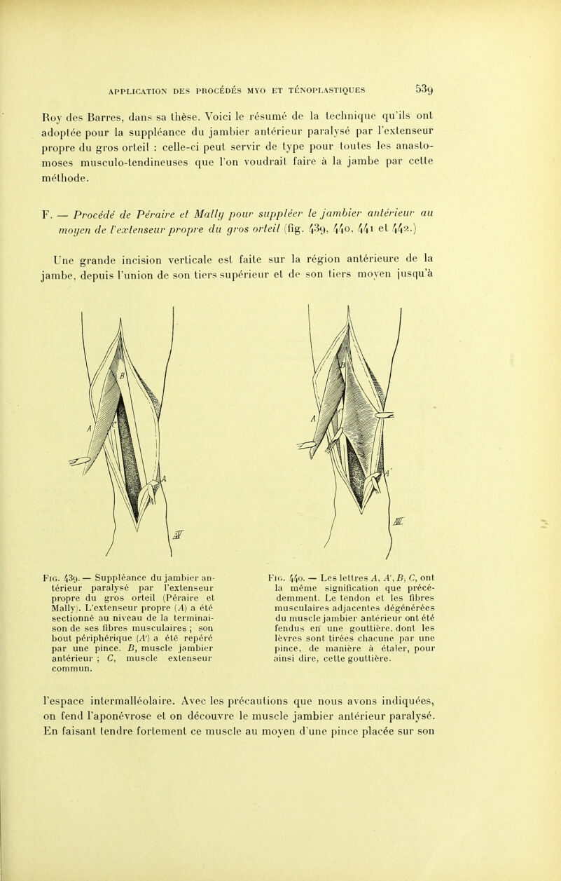 Roy des Barres, dans sa thèse. Voici le résumé de la technique qu'ils ont adoptée pour la suppléance du jambier antérieur paralysé par l'extenseur propre du gros orteil : celle-ci peut servir de type pour toutes les anasto- moses musculo-tendineuses que l'on voudrait faire à la jambe par cette méthode. F. — Procédé de Péraire et Mallij pour suppléer le jambier antérieur au moyen de iextenseur propre du gros orteil (fig. 439, 440i 44i et 442.) Une grande incision verticale est faite sur la région antérieure de la jambe, depuis l'union de son tiers supérieur et de son tiers moyen jusqu'à Fig. 439.— Suppléance du jambier an- térieur paralysé par l'extenseur propre du gros orteil (Péraire et Mally). L'extenseur propre (A) a été sectionné au niveau de la terminai- son de ses fibres musculaires ; son bout périphérique {A') a été repéré par une pince. B, muscle jambier antérieur ; C, muscle extenseur commun. FiG. 44o. — Les lettres A, A', B, C, ont la même signification que précé- demment. Le tendon et les fibres musculaires adjacentes dégénérées du muscle jambier antérieur ont été fendus en' une gouttière, dont les lèvres sont tirées chacune par une pince, de manière à étaler, pour ainsi dire, cette gouttière. l'espace intermalléolaire. Avec les précautions que nous avons indiquées, on fend l'aponévrose et on découvre le muscle jambier antérieur paralysé. En faisant tendre fortement ce muscle au moyen d'une pince placée sur son