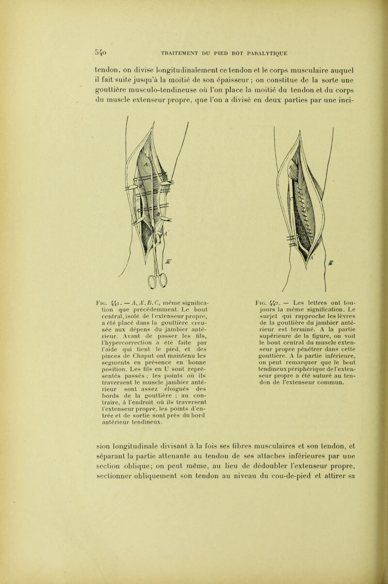 tendon, on divise longiludinalemenl ce tendon et le corps musculaire auquel il fait suite jusqu'à la moitié de son épaisseur ; on constitue de la sorte une gouttière musculo-tendineuse où l'on place la moitié du tendon et du corps du muscle extenseur propre, que Ton a divisé en deux parties par une inci- Fic. 4^1. — A,A',B,C., iiicme signilica- Uon que precc(Jemment. Le bout central, isolé de l'extenseur propre, a été placé dans la gouttière creu- sée aux dépens du jarnbier anté- rieur. Avant de passer les fils, l'hypercorreclion a été faite par l'aide (lui tient le pied, et des pinces de r,lia|)ul ont maintenu les segments en présence en bonne position. Les fils en U sont repré- sentés passés ; les points où ils traversent le muscle jambier anté- rieur sont assez éloignés des bords de la gouttière ; au con- traire, à l'endroit où ils traversent l'extenseur propre, les points d'en- trée et de sortie sont près du bord antérieur tendineux. FiG. 442. — Les lettres ont tou- jours la même signification. Le surjet qui rapproche les lèvres de la gouttière du jambier anté- rieur est terminé. A la partie supérieure de la figure, on voit le bout central du muscle exten- seur propre pénétrer dans cette gouttière. A la partie inférieure, on peut remarquer que le bout tendineux périphérique de l'exten- seur propre a été suturé au ten- don de l'extenseur commun. sion longitudinale divisant à la fois ses fibres musculaires et son tendon, et séparant la partie attenante au tendon de ses attaches inférieures par une section oblique; on peut même, au lieu de dédoubler l'extenseur propre, sectionner obliquement son tendon au niveau du cou-de-pied et attirer sa