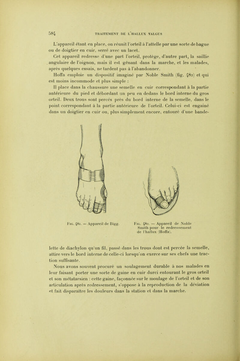 L'appareil étant en place, on réunit l'orteil à l'attelle par une sorte de bague ou de doigtier en cuir, serré avec un lacet. Cet appareil redresse d'une part l'orteil, protège, d'autre part, la saillie angulaire de l'oignon, mais il est gênant dans la marche, et les malades, après quelques essais, ne tardent pas à l'abandonner. HofTa emploie un dispositif imaginé par Noble Smith (fig. ^182) et qui est moins incommode et plus simple : Il place dans la chaussure une semelle en cuir correspondant à la partie antérieure du pied et débordant un peu en dedans le bord interne du gros orteil. Deux trous sont percés près du bord interne de la semelle, dans le point correspondant à la partie antérieure de l'orteil. Celui-ci est engainé dans un doigtier en cuir ou, plus simplement encore, entouré d'une bande- Fio. 481. — Appareil de Bigg. Fig. 48-2. — Api)areil de Nol)le Smilh pour le redrepseinent de I hallux (Hoffa). lette de diachylon qu'un fil, passé dans les trous dont est percée la semelle, attire vers le bord interne de celle-ci lorsqu'on exerce sur ses chefs une trac- tion suffisante. Nous avons souvent procuré un soulagement durable à nos malades en leur faisant porter une sorte de gaine en cuir durci entourant le gros orteil et son métatarsien : cette gaine, façonnée sur le moulage de l'orteil et de son articulation après redressement, s'oppose à la reproduction de la déviation «t fait disparaître les douleurs dans la station et dans la marche.