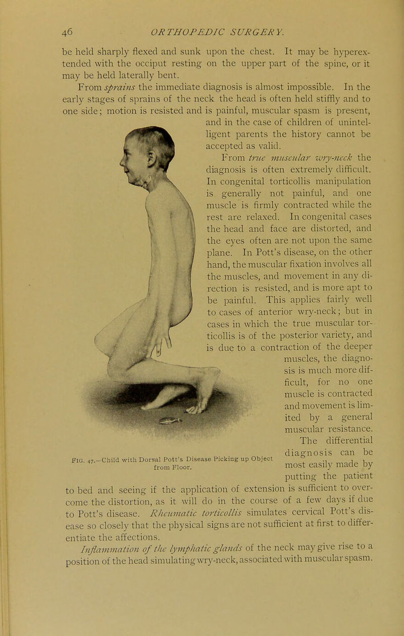 be held sharply flexed and sunk upon the chest. It may be hyperex- tended with the occiput resting on the upper part of the spine, or it may be held laterally bent. From sprains the immediate diagnosis is almost impossible. In the early stages of sprains of the neck the head is often held stiffly and to one side; motion is resisted and is painful, muscular spasm is present, and in the case of children of unintel- ligent parents the history cannot be accepted as valid. From tnic miisailar wry-neck the diagnosis is often extremely difficult. In congenital torticollis manipulation is generally not painful, and one muscle is firmly contracted while the rest are relaxed. In congenital cases the head and face are distorted, and the eyes often are not upon the same plane. In Pott's disease, on the other hand, the muscular fixation involves all the muscles, and movement in any di- rection is resisted, and is more apt to be painful. This applies fairly well to cases of anterior wry-neck; but in cases in which the true muscular tor- ^ V ticollis is of the posterior variety, and is due to a contraction of the deeper muscles, the diagno- sis is much more dif- ficult, for no one muscle is contracted and movement is lim- ited by a general muscular resistance. The differential diagnosis can be most easily made by putting the patient to bed and seeing if the application of extension is sufficient to over- come the distortion, as it will do in the course of a few days if due to Pott's disease. Rheumatic torticollis simulates cervical Pott's dis- ease so closely that the physical signs are not sufficient at first to differ- entiate the affections. Inflammation of the lymphatic glands of the neck may give rise to a position of the head simulating wry-neck, associated with muscular spasm. Fig. 47- -Child with Dorsal Pott's Disease Picking up Object from Floor.