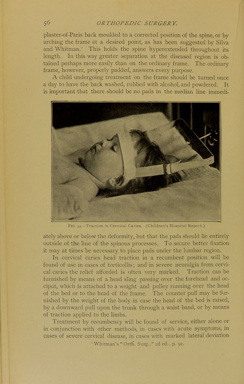 plaster-of-Paris back moulded to a corrected position of the spine, or by arching the frame at a desired point, as has been suggested by Silva and Whitman.' This holds the spine hyperextended throughout its length. In this way greater separation at the diseased region is ob- tained perhaps more easily than on the ordinary frame. The ordinary frame, however, properly padded, answers every purpose. A child undergoing treatment on the frame should be turned once a day to have the back washed, rubbed with alcohol, and powdered. It is important that there should be no pads in the median line immedi- FlG. 54.—Traction in Cervical Caries. (Children's Hospital Report.) ately above or below the deformity, but that the pads should lie entirely outside of the line of the spinous processes. To secure better fixation it may at times be necessary to place pads under the lumbar region. In cervical caries head traction in a recumbent position will be found of use in cases of torticollis; and in severe neuralgia from cervi- cal caries the relief afforded is often very marked. Traction can be furnished by means of a head sling passing over the forehead and oc- ciput, which is attached to a weight and pulley running over the head of the bed or to the head of the frame. The counter pull may be fur- nished by the weight of the body in case the head of the bed is raised, by a downward pull upon the trunk through a waist band, or by means of traction applied to the limbs. Treatment by recumbency will be found of service, either alone or in conjunction with other methods, in cases with acute symptoms, in cases of severe cervical disease, in cases with marked lateral deviation ' Whitman's  Ortli. Surg-., 2d ed., p. 91.