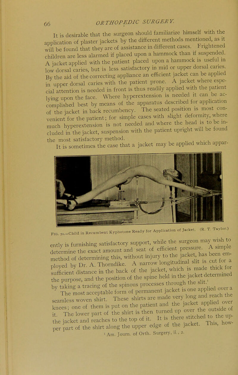 It is desirable that the surgeon should familiarize himself with the application of plaster jackets by the different methods mentioned, as it will be found that they are of assistance in different cases. \ nghtened children are less alarmed if placed upon a hammock than if suspended. A iacket applied with the patient placed upon a hammock is useful in lovv dorsal caries, but is less satisfactory in mid or upper dorsal caries Bv the aid of the correcting appliance an efficient jacket can be applied in upper dorsal caries with the patient prone. A jacket where espe- cial attention is needed in front is thus readily applied with the patient Wing upon the face. Where hyperextension is needed it can be ac- complished best by means of the apparatus described for application of the jacket in back recumbency. The seated position is most con- venient for the patient; for simple cases with slight deformity, vvhere much hyperextension is not needed and where the head is to be in- cluded in the jacket, suspension with the patient upright will be found the most satisfactory method. It is sometimes the case that a jacket may be applied which appar- FIG. 7o.-Child in Recumbent Kyphotone Ready for Application of Jacket. (R. T. Taylor.) entlv is furnishing satisfactory support, while the surgeon may wish to dete'rmine the exfct amount and seat of efacient P—^^^^^^^^^^ method of determining this, without injury to ^he pcket has be n em ployed by Dr. A. Thorndike. A narrow longitudinal slit s cut for a sufficient distance in the back of the jacket, which is made thick for :hf ;;^30se, and the position of the spine held in the bv takine a tracing of the spinous processes through the slit. ?he SiosLce^table form of permanent jacket is one ^^^^^^ seamless woven shirt. These shirts are made very long and each the .e one of them is put on the patient and the it The lower part of the shirt is then turned up ovei the outs de of he jacket and Laches to the top of it. It is there ^'f^-^'J^^'^^.- per part of the shirt along the upper edge of the jacket. This, how ' Am. Journ. of Orth. Surgery, n., 2.
