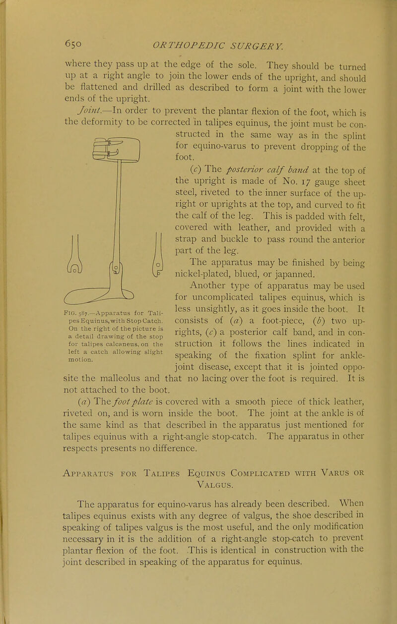 where they pass up at the edge of the sole. They should be turned up at a right angle to join the lower ends of the upright, and should be flattened and drilled as described to form a joint with the lower ends of the upright. Joint.—\\\ order to prevent the plantar flexion of the foot, which is the deformity to be corrected in talipes equinus, the joint must be con- structed in the same way as in the splint for equino-varus to prevent dropping of the foot. ic) The posierio}' calf band at the top of the upright is made of No. 17 gauge sheet steel, riveted to the inner surface of the up- right or uprights at the top, and curved to fit the calf of the leg. This is padded with felt, covered with leather, and provided with a strap and buckle to pass round the anterior part of the leg. The apparatus may be finished by being nickel-plated, blued, or japanned. Another type of apparatus may be used for uncomplicated talipes equinus, which is less unsightly, as it goes inside the boot. It consists of («) a foot-piece, {b) two up- rights, (c) a posterior calf band, and in con- struction it follows the lines indicated in speaking of the fixation splint for ankle- joint disease, except that it is jointed oppo- site the malleolus and that no lacing over the foot is required. It is not attached to the boot. {a) The foot plate is covered with a smooth piece of thick leather, riveted on, and is worn inside the boot. The joint at the ankle is of the same kind as that described in the apparatus just mentioned for talipes equinus with a right-angle stop-catch. The apparatus in other respects presents no difference. Apparatus for Talipes Equinus Complicated with Varus or Valgus. The apparatus for equino-varus has already been described. When talipes equinus exists with any degree of valgus, the shoe described in speaking of talipes valgus is the most useful, and the only modification necessary in it is the addition of a right-angle stop-catch to prevent plantar flexion of the foot. This is identical in construction with the joint described in speaking of the apparatus for equinus. Fig. 5S7.—Apparatus for Tali- pes Equinus, with Stop Catch. On the rigfht of the picture is a detail drawing of the stop for talipes calcaneus, on the left a catch allowing slight motion.