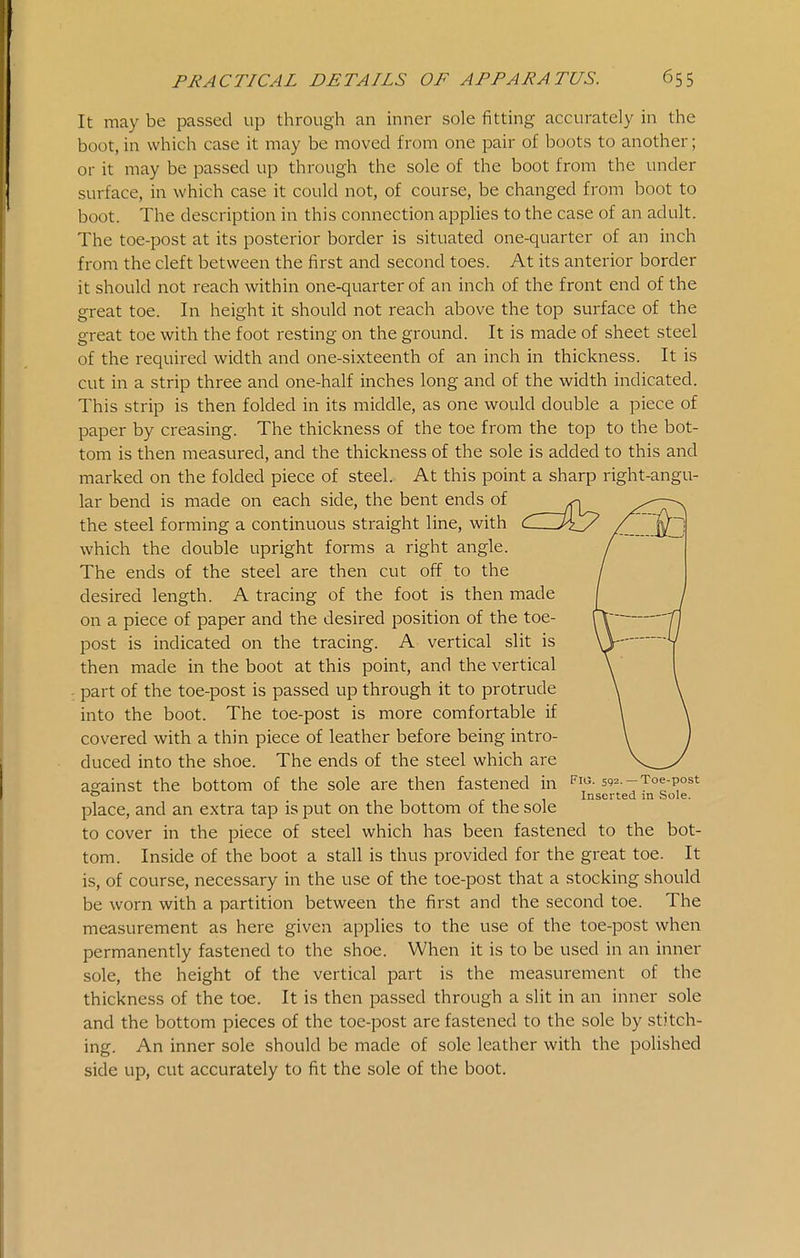 It may be passed up through an inner sole fitting accurately in the boot, in which case it may be moved from one pair of boots to another; or it may be passed up through the sole of the boot from the under surface, in which case it could not, of course, be changed from boot to boot. The description in this connection applies to the case of an adult. The toe-post at its posterior border is situated one-quarter of an inch from the cleft between the first and second toes. At its anterior border it should not reach within one-quarter of an inch of the front end of the great toe. In height it should not reach above the top surface of the great toe with the foot resting on the ground. It is made of sheet steel of the required width and one-sixteenth of an inch in thickness. It is cut in a strip three and one-half inches long and of the width indicated. This strip is then folded in its middle, as one would double a piece of paper by creasing. The thickness of the toe from the top to the bot- tom is then measured, and the thickness of the sole is added to this and marked on the folded piece of steel. At this point a sharp right-angu- lar bend is made on each side, the bent ends of ^ the steel forming a continuous straight line, with C— which the double upright forms a right angle. / The ends of the steel are then cut off to the / desired length. A tracing of the foot is then made / on a piece of paper and the desired position of the toe- R- -y1 post is indicated on the tracing. A vertical slit is \\ V then made in the boot at this point, and the vertical \ part of the toe-post is passed up through it to protrude \ \ into the boot. The toe-post is more comfortable if \ \ covered with a thin piece of leather before being intro- \ ) duced into the shoe. The ends of the steel which are against the bottom of the sole are then fastened in fio. 592--Toe-post ° 1 r 1 1 Inserted m Sole. place, and an extra tap is put on the bottom of the sole to cover in the piece of steel which has been fastened to the bot- tom. Inside of the boot a stall is thus provided for the great toe. It is, of course, necessary in the use of the toe-post that a stocking should be worn with a partition between the first and the second toe. The measurement as here given applies to the use of the toe-post when permanently fastened to the shoe. When it is to be used in an inner sole, the height of the vertical part is the measurement of the thickness of the toe. It is then passed through a slit in an inner sole and the bottom pieces of the toe-post are fastened to the sole by stitch- ing. An inner sole should be made of sole leather with the polished side up, cut accurately to fit the sole of the boot.