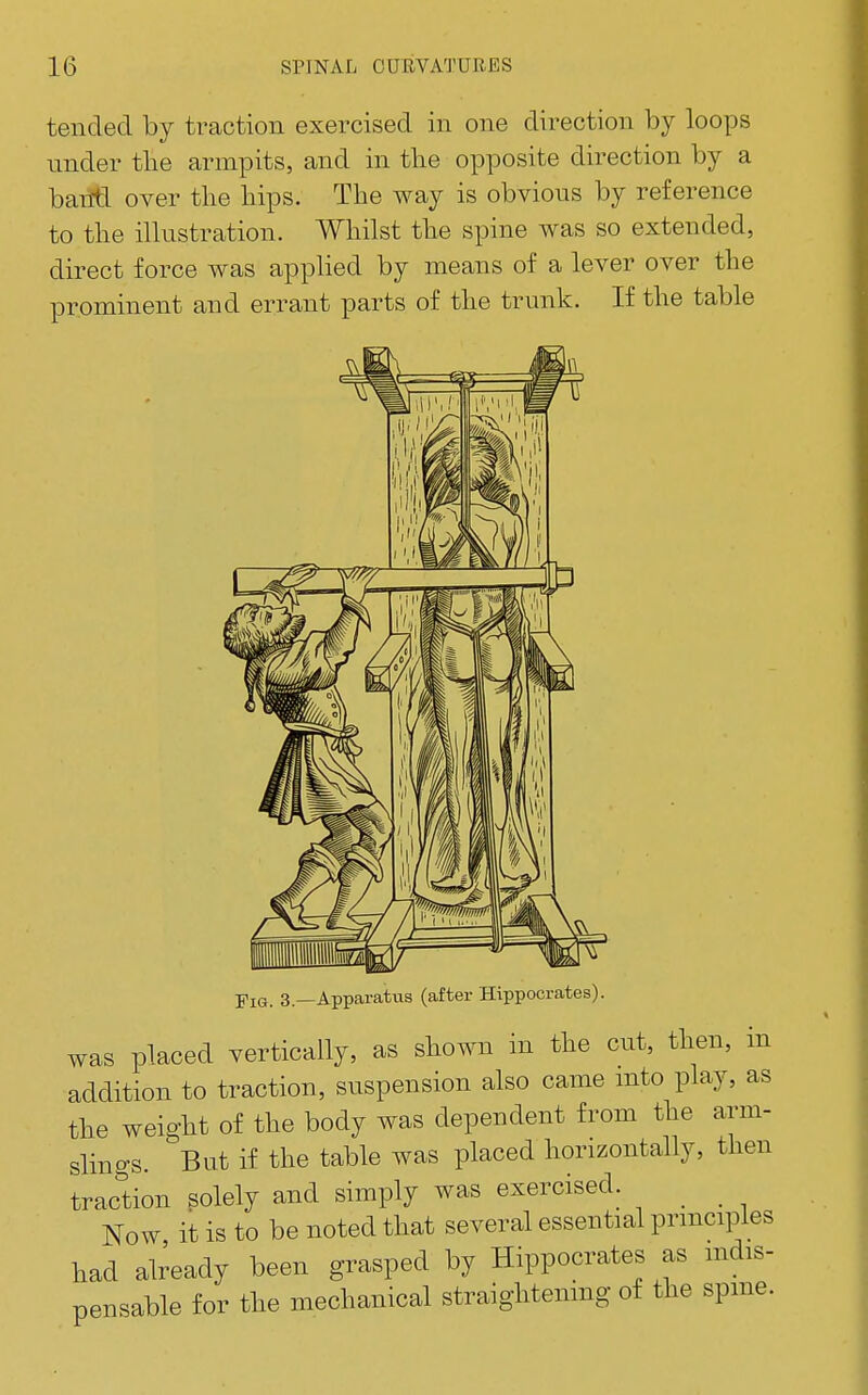 tended by traction exercised in one direction by loops nnder the armpits, and in tbe opposite direction by a bailtl over the hips. The way is obvious by reference to the illustration. Whilst the spine was so extended, direct force was applied by means of a lever over the prominent and errant parts of the trunk. If the table Fig. 3.—Apparatus (after Hippocrates). was placed vertically, as shown in the cut, then, in addition to traction, suspension also came mto play, as the weight of the body was dependent from the arm- slings. But if the table was placed horizontally, then trac'tion solely and simply was exercised. Now it is to be noted that several essential principles had abeady been grasped by Hippocrates as mdis- pensable for the mechanical straightenmg of the spme.