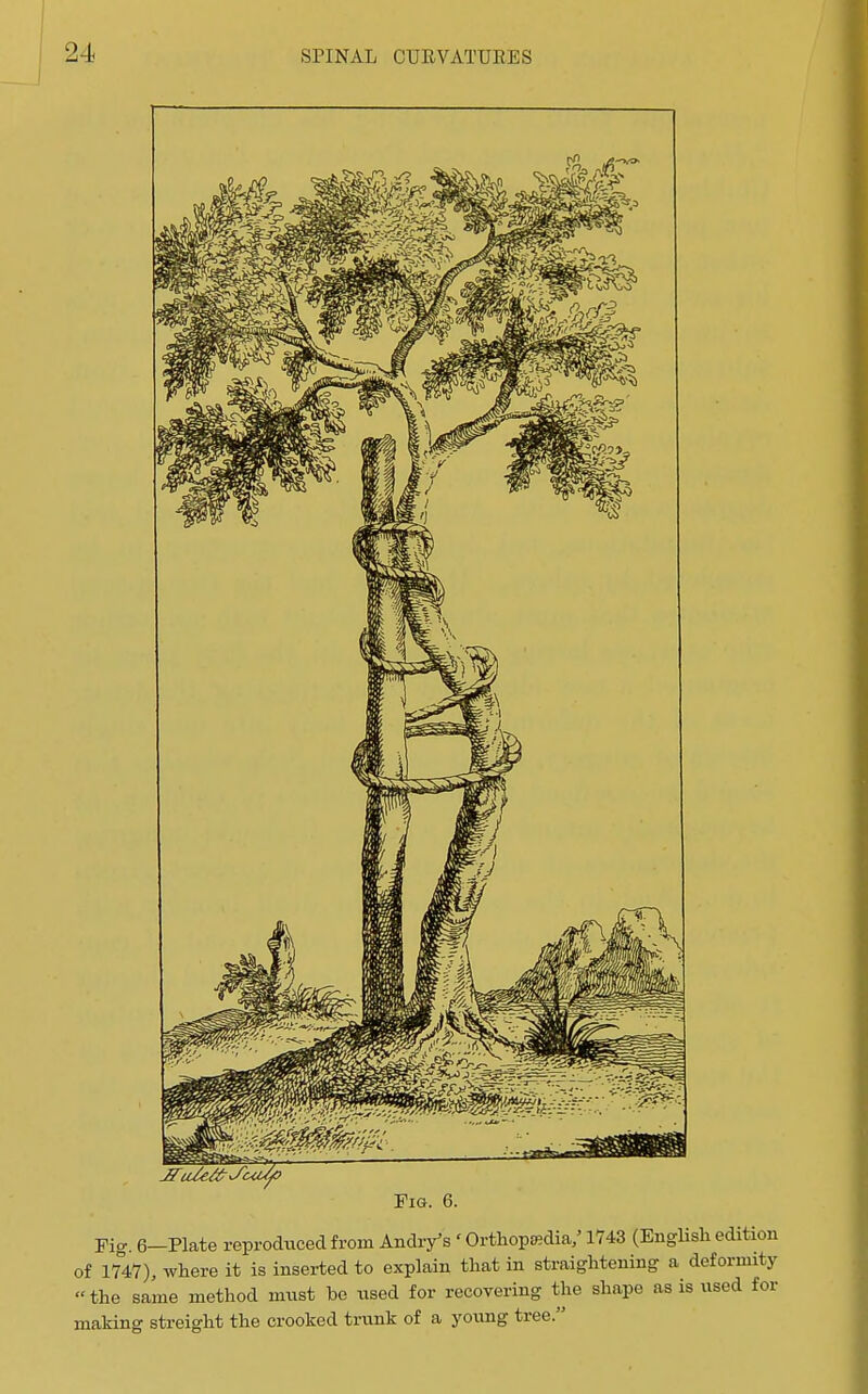 Fm. 6. Fig. 6-Plate reproduced from Andry's ' Orthopojdia/1743 (English edition of 1747), where it is inserted to explain that in straightening a deformity the same method mnst be used for recovering the shape as is used for making streight the crooked trunk of a yormg tree.