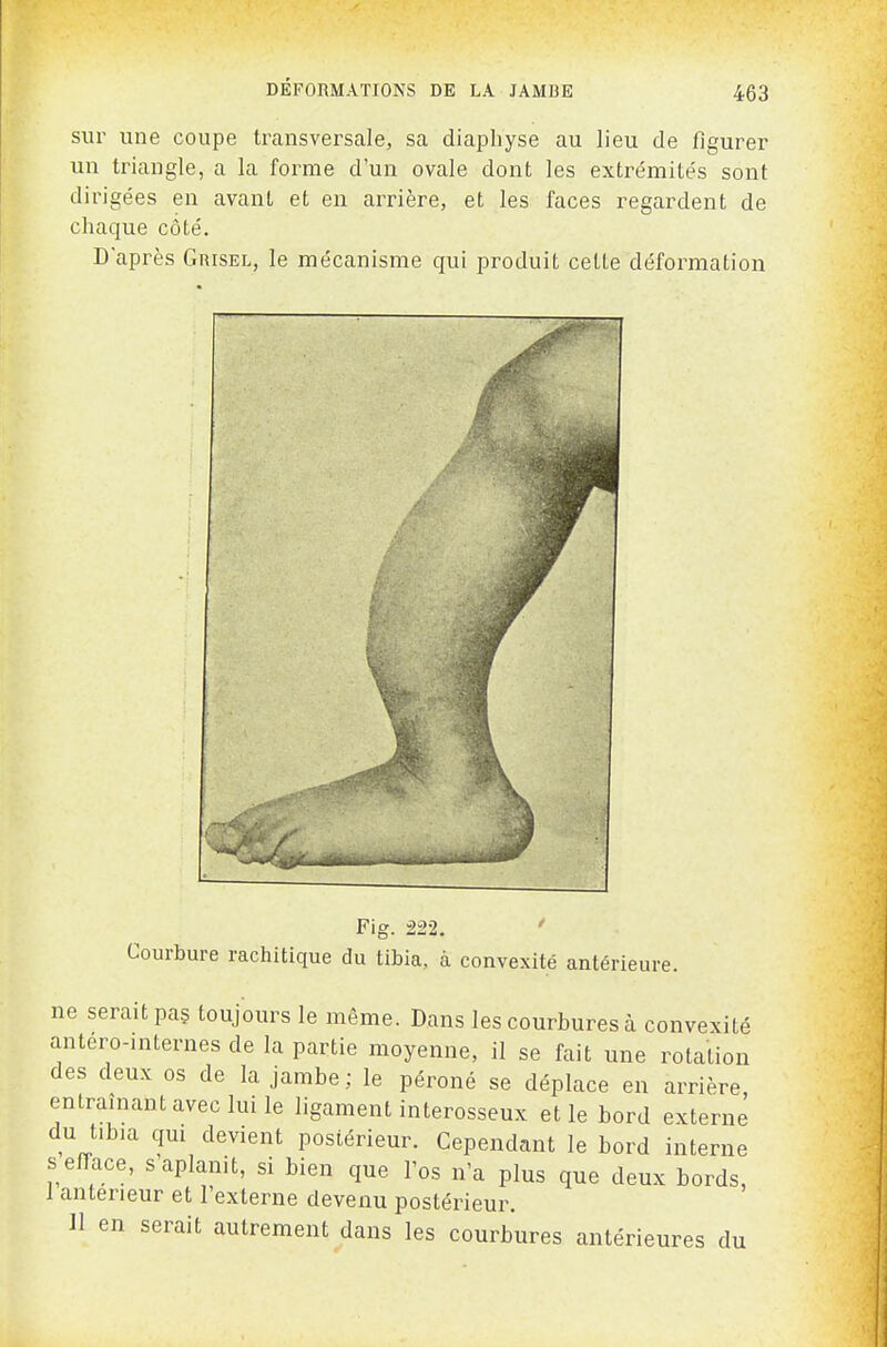 sur une coupe transversale, sa diaphyse au lieu de figurer un triangle, a la forme d'un ovale dont les extrémités sont dirigées en avant et en arrière, et les faces regardent de chaque côté. D'après Grisel, le mécanisme qui produit cette déformation Fig. 222. Courbure rachitique du tibia, à convexité antérie ure. ne serait pas toujours le même. Dans les courbures à convexité antero-internes de la partie moyenne, il se fait une rotation des deux os de la jambe; le péroné se déplace en arrière entraînant avec lui le ligament interosseux et le bord externe du tibia qui devient postérieur. Cependant le bord interne s efface, s aplanit, si bien que l'os n'a plus que deux bords, I antérieur et l'externe devenu postérieur. n en serait autrement dans les courbures antérieures du