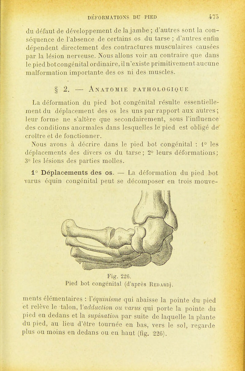 du défaut de développement de la jambe ; d'autres sont la con- séquence de l'absence de certains os du tarse ; d'autres enfin dépendent directement des contractures musculaires causées par la lésion nerveuse. Nous allons voir au contraire que dans le pied botcongénital ordinaire, iln'existe primitivement aucune malformation importante des os ni des muscles. § 2. — Anatomie pathologique La déformation du pied bot congénital résulte essentielle- ment du déplacement des os les uns par rapport aux autres; leur forme ne s'altère que secondairement, sous l'influence des conditions anormales dans lesquelles le pied est obligé de' croître et de fonctionner. Nous avons à décrire dans le pied bot congénital : 1° les déplacements des divers os du tarse; 2° leurs déformations; 3° les lésions des parties molles. 1° Déplacements des os. — La déformation du pied bot varus équin congénital peut se décomposer en trois mouve- Fig. 226. Pied bot congénital (d'après Redard). ments élémentaires : Véquinisme qui abaisse la pointe du pied et relève le talon, l'adduciion ou varus qui porte la pointe du pied en dedans et la supination par suite de laquelle la plante du pied, au lieu d'être tournée en bas, vers le sol, regarde plus ou moins en dedans ou eu haut (fig, 226).