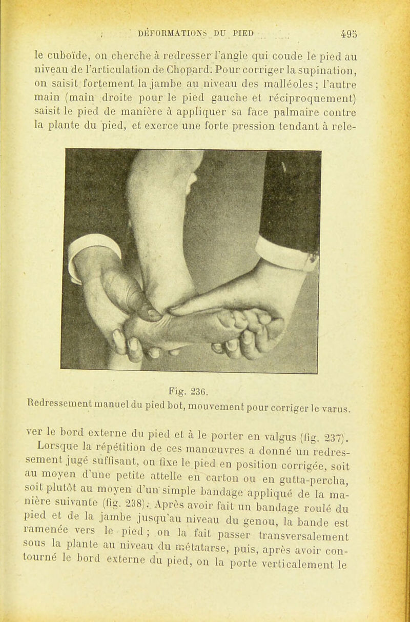 ; ' DÉFORMATIONS DU PIED 49;j le cuboïde, on cherche à redresser l'angle qui coude le pied au niveau de l'articulation de Chopard. Pour corriger la supination, on saisit fortement la jambe au niveau des malléoles; l'autre main (main droite pour le pied gauche et réciproquement) saisit le pied de manière à appliquer sa face palmaire contre la plante du pied, et exerce une forte pression tendant à rele- Fig. 23G. Redressement manuel du pied bot, mouvement pour corriger le varus. ver le bord externe du pied et h le porter en valgus (fig. 237). Lorsque la répétition de ces manœuvres a donné un redres- sement jugé suffisant, on fixe le pied en position corrigée, soit au moyen d'une petite attelle en carton ou en gutta-percha soit plutôt au moyen d'un simple bandage appliqué de la ma- nière suivante (lig. 238); Après avoir fait un bandage roulé du pied et de la jambe jusqu'au niveau du genou, la bande est ramenée vers le pied ; on la fait passer transversalement sous la plante au niveau du métatarse, puis, après avoir con- tourne le bord externe du pied, on la porte verticalement le