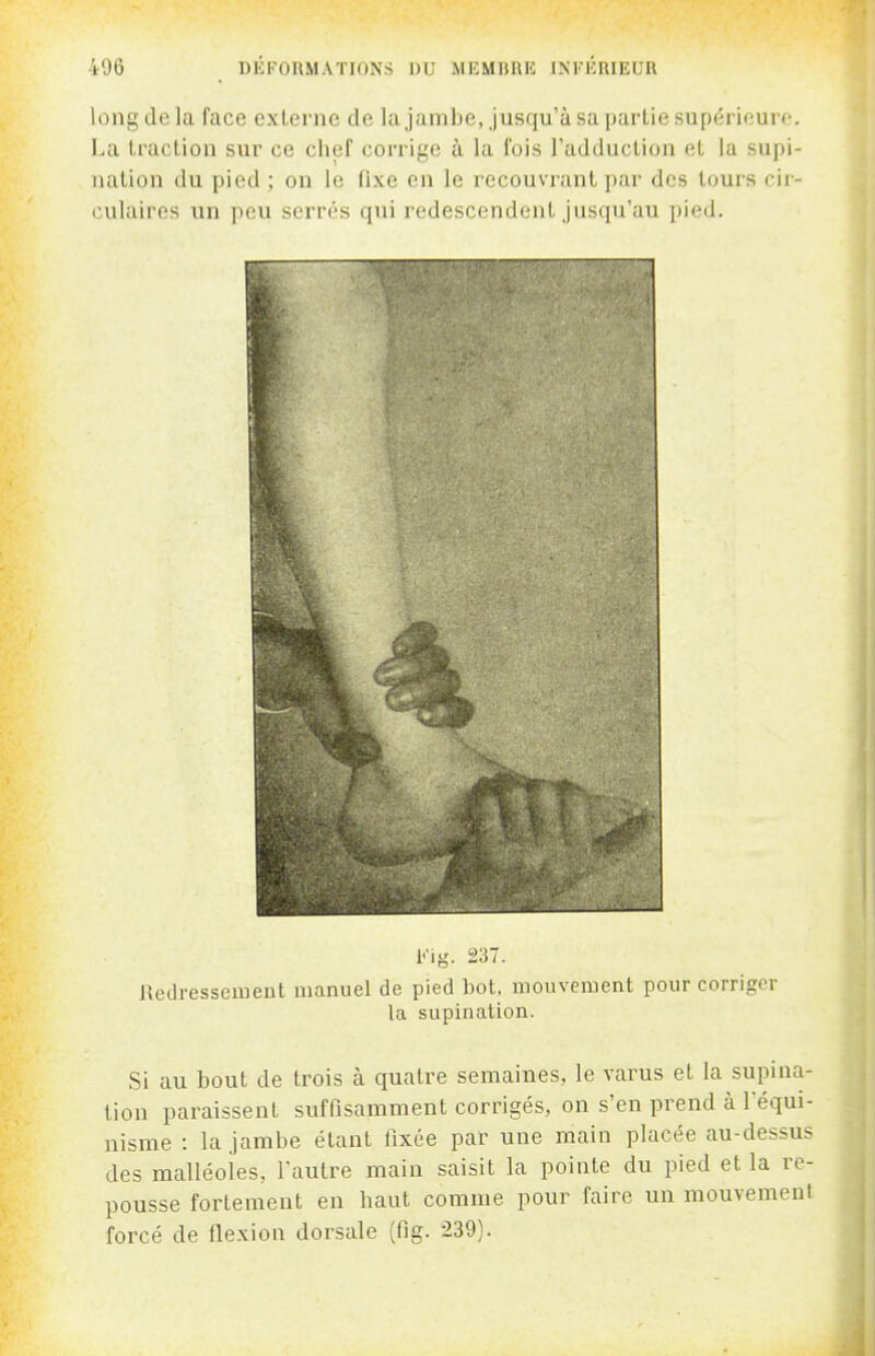 long do la face cxlernc de lu jiinibc,.jusqu'à sa partie supérieuro. La traction sur ce clief corrige à la fois l'adduction et la supi- nation du pied ; on le fixe en le recouvrant par des tours cii - culaires un peu serrés qui redescendent jusqu'au pied. Redressement manuel de pied bot. mouvement pour corriger la supination. Si au bout de trois à quatre semaines, le varus et la supina- tion paraissent suffisamment corrigés, on s'en prend à l'équi- nisme : la jambe étant fixée par une main placée au-dessus des malléoles, l'autre main saisit la pointe du pied et la re- pousse fortement en haut comme pour faire un mouvement forcé de flexion dorsale (fig. 239).