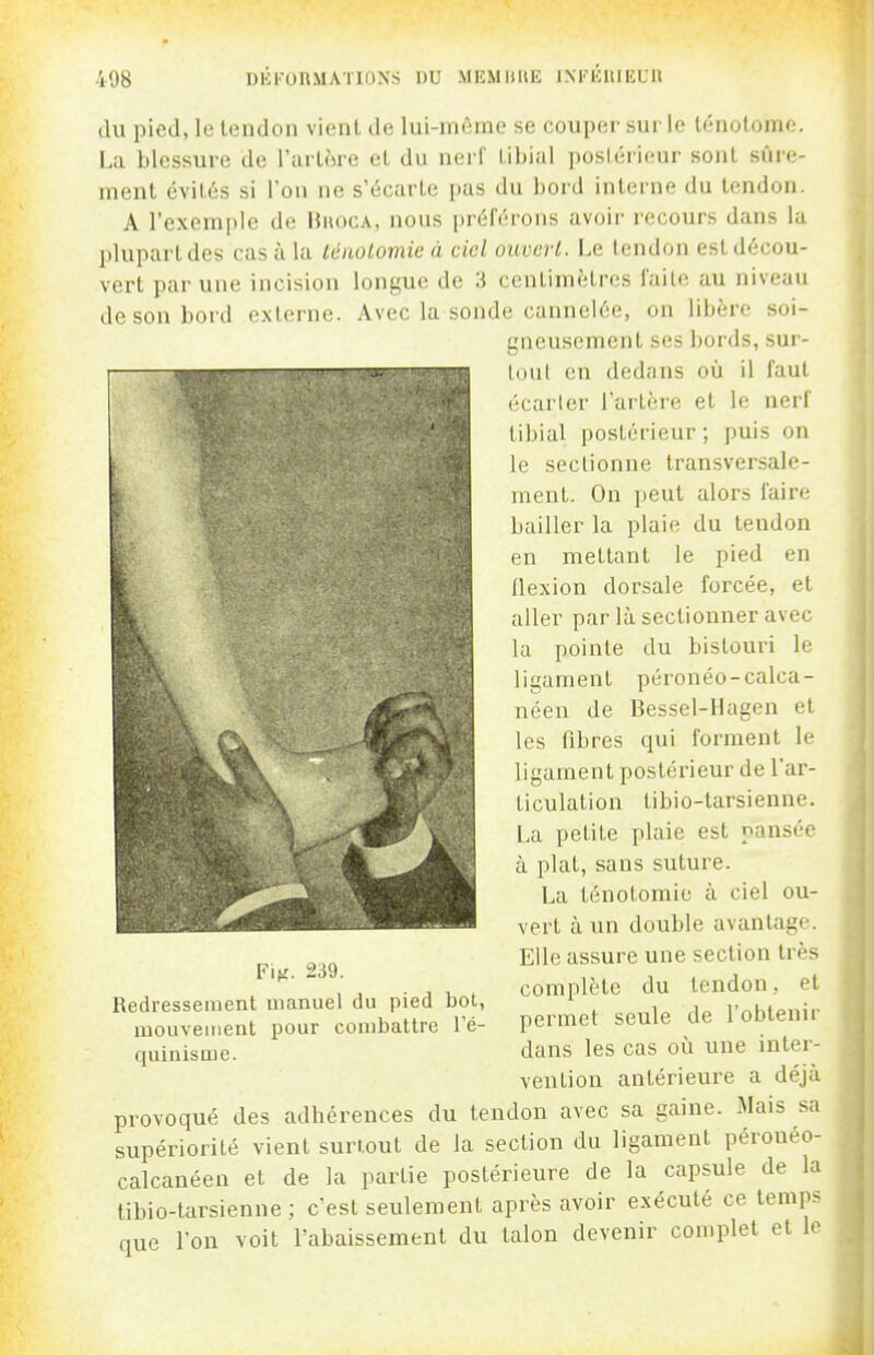 DKKUUMATIDNS DU MEMllIlE INKlillIEUa du pied, le lendon vient de lui-même se couper sur le ténotome. La blessure de l'artnre et du nei l tibia! postérieur sont sûre- ment évités si l'on ne s'écarte pas du bord interne du tendon. A l'exemple de Hhoca, nous préférons avoir recours dans la plupart des cas à la Icnolomie à ciel ouvert. Le tendon est décou- vert par une incision longue de 3 centimètres faite au niveau de son bord externe. Avec la sonde cannelée, on libère soi- gneusement ses bords, sur- tout en dedans où il faut écarter l'artère et le nerf tibial postérieur; puis on le sectionne transversale- ment. On peut alors faire bailler la plaie du tendon en mettant le pied en flexion dorsale forcée, et aller par là sectionner avec la pointe du bistouri le ligament péronéo-calca- néen de Bessel-Hagen et les fibres qui forment le ligament postérieur de l'ar- ticulation tibio-tarsienne. La petite plaie est pansée à plat, sans suture. La ténotomie à ciel ou- vert à un double avantage. Elle assure une section très complète du tendon, et permet seule de l'obtenir dans les cas oîi une inter- vention antérieure a déjà provoqué des adhérences du tendon avec sa gaine. Mais sa supériorité vient surtout de la section du ligament péronéo- calcanéen et de la partie postérieure de la capsule de la tibio-tarsienne; c'est seulement après avoir exécuté ce temps que l'on voit l'abaissement du talon devenir complet et le Fif;. 239. Redressement manuel du pied bot, mouvement pour combattre l'é- quinisme.