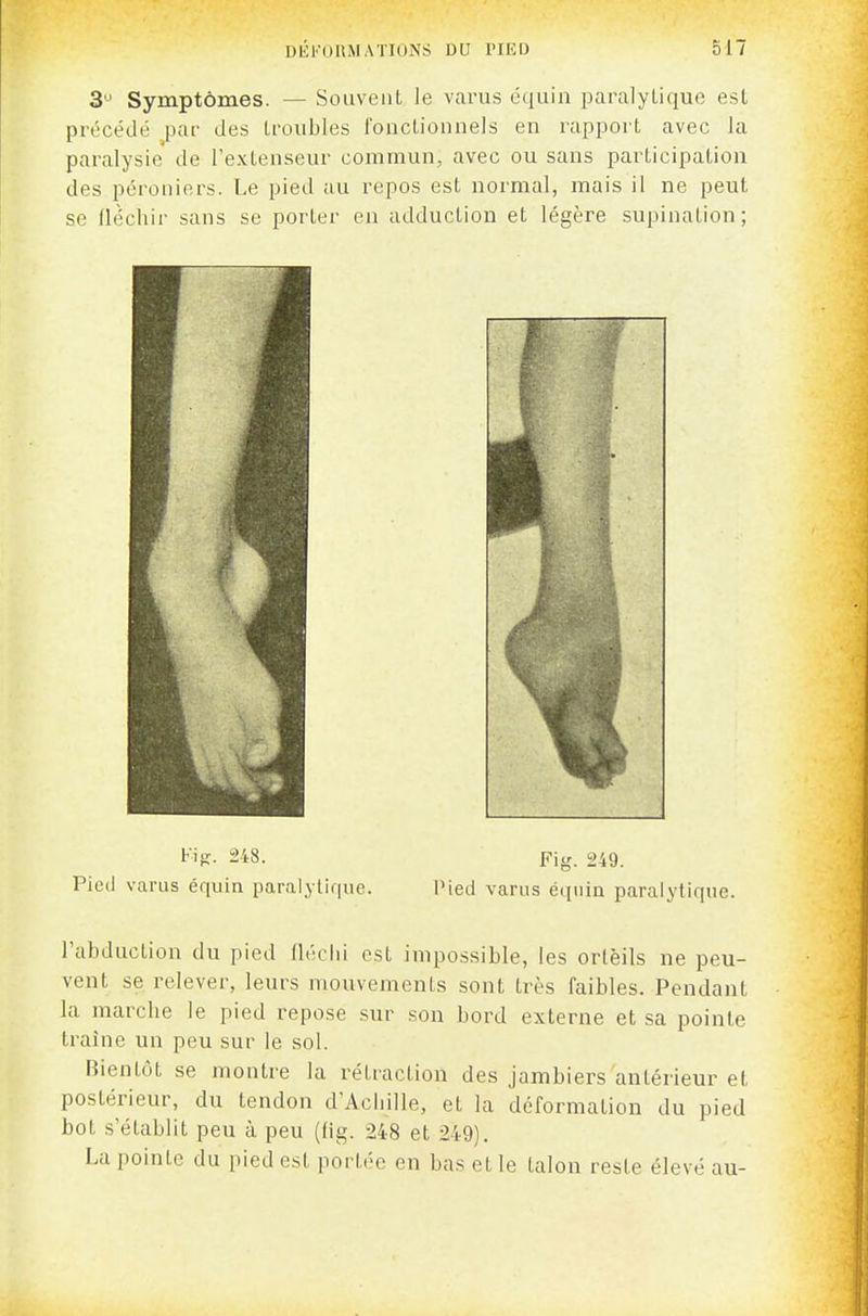 3^' Symptômes. — SouveiiL le varus équin paralytique est précédé j3ai- des troubles i'ouctionnels en rapport avec la paralysie de l'extenseur commun, avec ou sans participation des péroniers. Le pied au repos est normal, mais il ne peut se fléchir sans se porter en adduction et légère supination; Fip:. 248. Fig. 249. Pied varus équin paralytique. Pied varus équin paralytique. l'abduction du pied fh-clii est impossible, les ortèils ne peu- vent se relever, leurs mouvements sont très faibles. Pendant la marche le pied repose sur son bord externe et sa pointe traîne un peu sur le sol. Bientôt se montre la rétraction des jambiers antérieur et postérieur, du tendon d'Acliille, et la déformation du pied bot s'établit peu à peu (lig. 248 et 249). La pointe du pied est portée en bas et le talon reste élevé au-