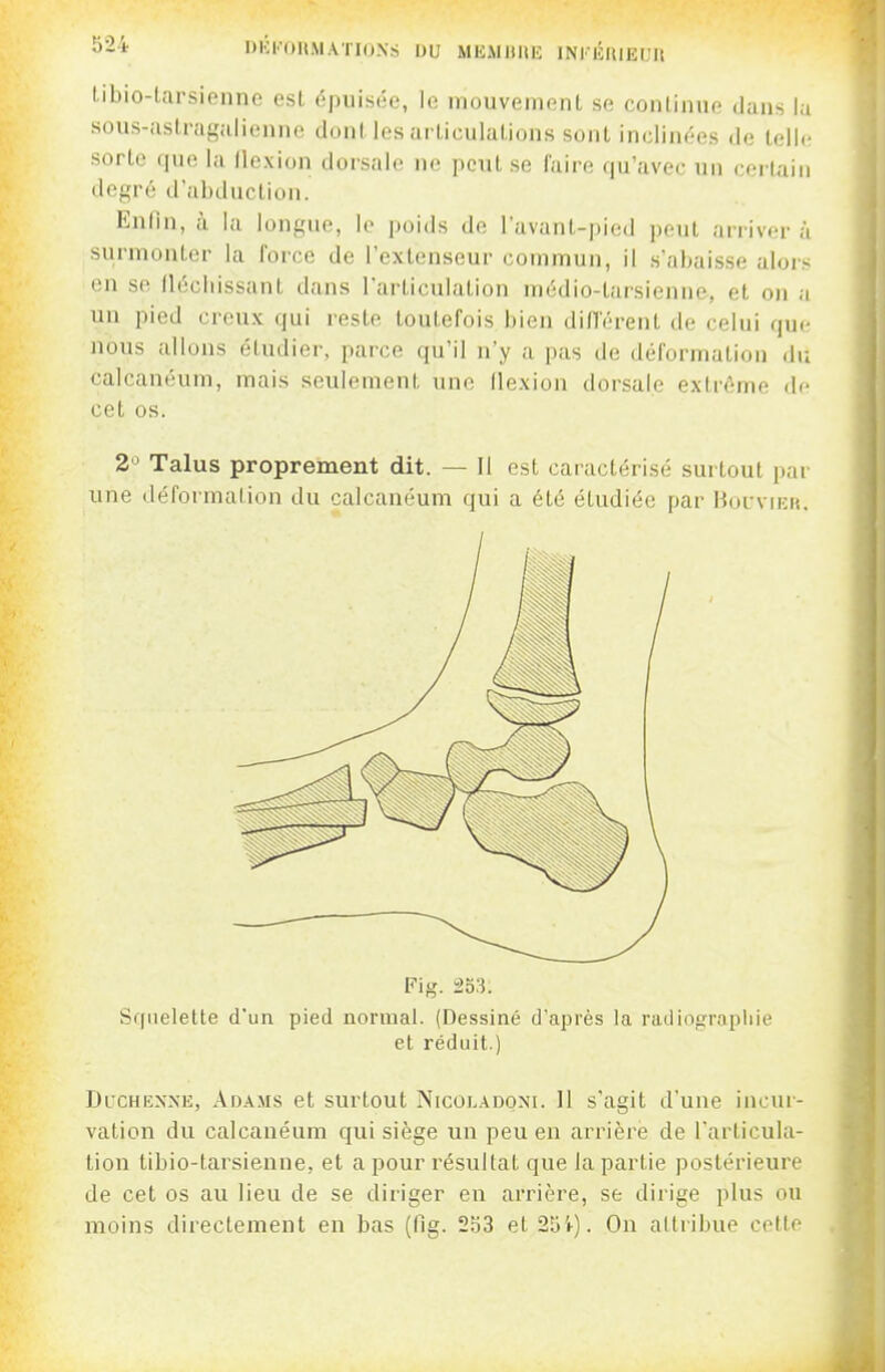 ^-•'l- l>l';i'(»ltMATI(JXS DU MUMltllE INKÉUIEUU libio-larsienne est épiiist-e, le mouvement se conlimie dans la sous-aslragalienno donl les arLiculalions sonl inclinées de lell(? sorte que la Ilexion dorsale ne peut se faire qu'avec un certain degré d'abduction. Enfin, à la longue, le poids de lavant-pied peut arrivera surmonter la force de l'extenseur commun, il s'abaisse alors en se llécliissant dans l'articulation médio-tarsienne, et on a un pied creux qui reste toutefois bien différent de celui que nous allons étudier, parce qu'il n'y a pas de déformation <lu calcanéum, mais seulement une flexion dorsale extrême de cet os. 2'^ Talus proprement dit. — Il est caractérisé surtout par une déformation du calcanéum qui a été étudiée par Moi-vn;u. Fig. 253. Sriiielelte d'un pied normal. (Dessiné d'après la railiograpliie et réduit.) DucHENXE, Adams et surtout Nicoladoni. 11 s'agit d'une incur- vation du calcanéum qui siège un peu en arrière de l'articula- tion tibio-tarsienne, et a pour résultat que la partie postérieure de cet os au lieu de se diriger en arrière, se dirige plus ou moins directement en bas (fig. 253 et 2îi'i-). Ou alliibue cotte