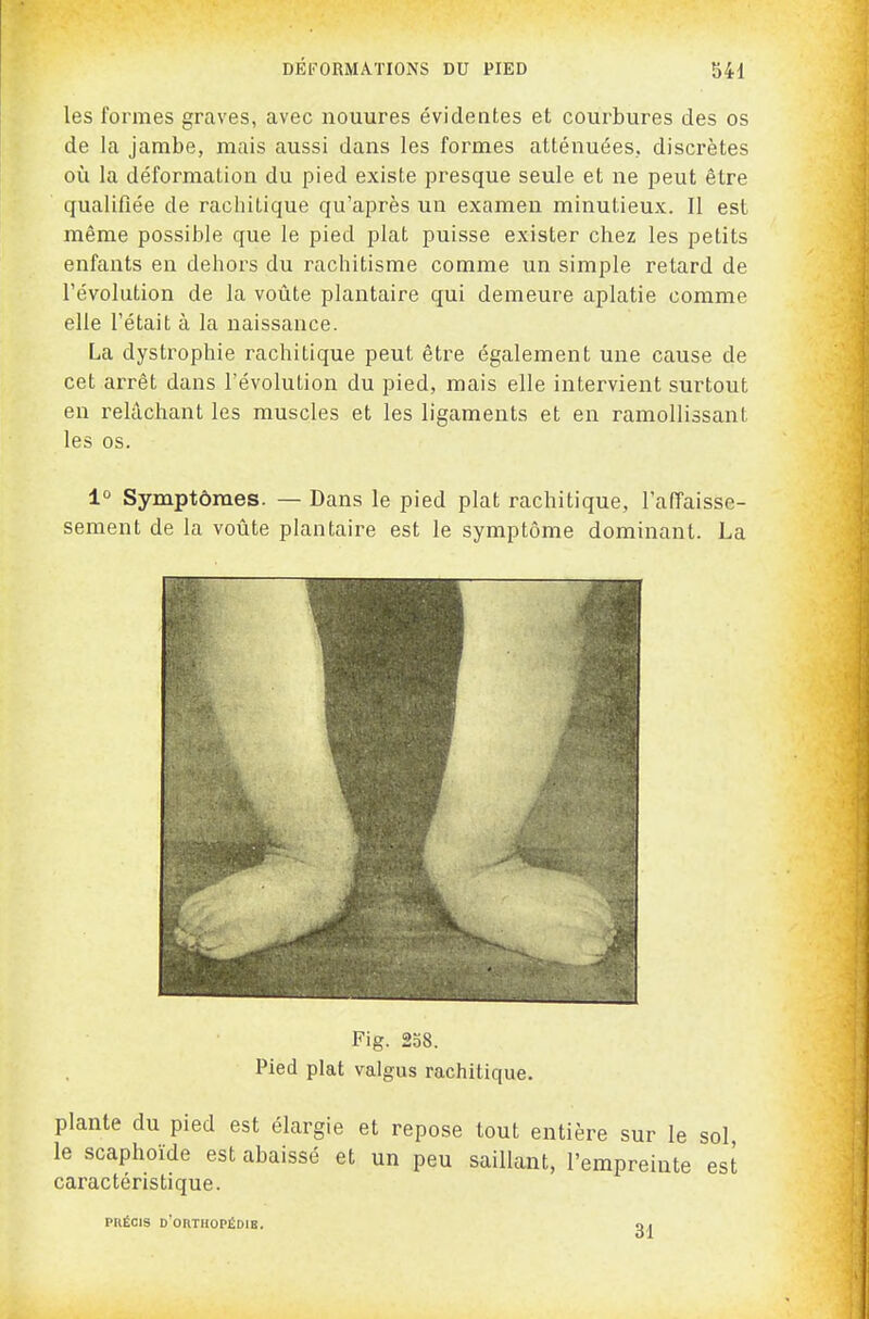 les formes graves, avec nouures évidentes et courbures des os de la jambe, mais aussi dans les foi^mes atténuées, discrètes où la déformation du pied existe presque seule et ne peut être qualifiée de rachitique qu'après un examen minutieux. Il est même possible que le pied plat puisse exister chez les petits enfants en dehors du rachitisme comme un simple retard de l'évolution de la voûte plantaire qui demeure aplatie comme elle l'était à la naissance. La dystrophie rachitique peut être également une cause de cet arrêt dans l'évolution du pied, mais elle intervient surtout en relâchant les muscles et les ligaments et en ramollissant les os. 1° Symptômes. — Dans le pied plat rachitique, l'aiïaisse- sement de la voûte plantaire est le symptôme dominant. La Fig. 238. Pied plat valgus rachitique. plante du pied est élargie et repose tout entière sur le sol le scaphoïde est abaissé et un peu saillant, l'empreinte est caractéristique. PRÉCIS d'orthopédie. n.