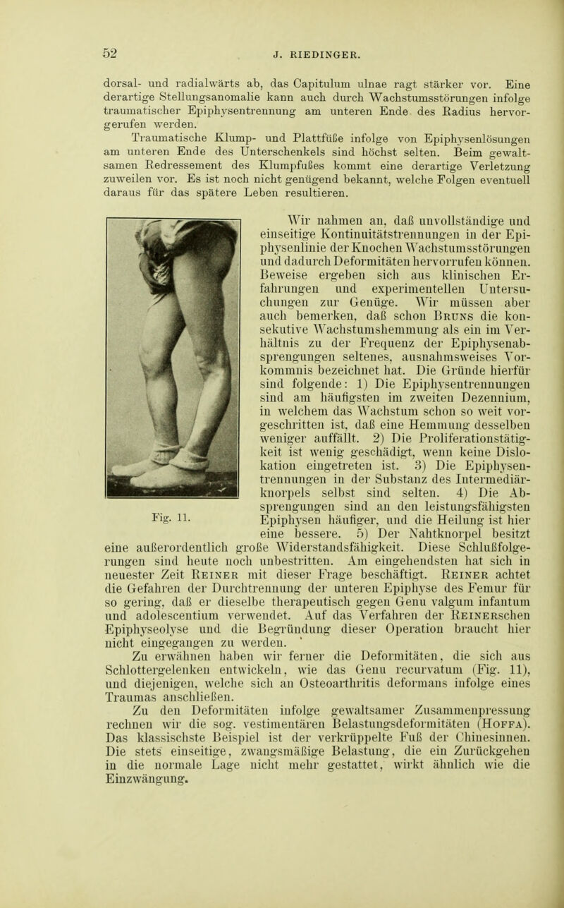 dorsal- und radialvvärts ab, das Capitulum ulnae ragt stärker vor. Eine derartige Stellungsanomalie kann auch durch Wachstumsstörungen infolge traumatischer Epiphj^sentrennung am unteren Ende des Radius hervor- gerufen werden. Traumatische Klump- und Plattfüße infolge von Epiphj'senlösungen am unteren Ende des Unterschenkels sind höchst selten. Beim gewalt- samen Redressement des Klumpfußes kommt eine derartige Verletzung zuweilen vor. Es ist noch nicht genügend bekannt, welche Folgen eventuell daraus für das spätere Leben resultieren. AVir uahnien an, daß unvollständige und einseitige Kontinuitätstrennungen in der Epi- phj'senliuie der Knochen Wachstumsstörungen und dadurch Deformitäten hervorrufen können. Beweise ergeben sich aus klinischen Er- fahrungen und experimentellen Untersu- chungen zur Genüge. Wir müssen aber auch bemerken, daß schon Bruns die kon- sekutive Wachstumshemmung als ein im Ver- hältnis zu der Frequenz der Epiphysenab- sprengungen seltenes, ausnahmsweises Vor- kommnis bezeichnet hat. Die Gründe hierfür sind folgende: 1) Die Epiphysentrenuungen sind am häufigsten im zweiten Dezennium, in welchem das Wachstum schon so weit vor- geschritten ist, daß eine Hemmung desselben weniger auffällt. 2) Die Proliferationstätig- keit ist wenig geschädigt, wenn keine Dislo- kation eingetreten ist. 3) Die Epiphj^sen- trennungen in der Substanz des Intermediär- knorpels selbst sind selten. 4) Die Ab- sprengungen sind an den leistungsfähigsten Epipliysen häufiger, und die Heilung ist hier eine bessere. 5) Der Nahtknorpel besitzt eine außerordentlich große Widerstandsfähigkeit. Diese Schlußfolge- rungen sind heute noch unbestritten. Am eingehendsten hat sich in neuester Zeit Reiner mit dieser Frage beschäftigt. Reiner achtet die Gefahren der Durchtrennung der unteren Epiphj'se des Femur für so gering, daß er dieselbe therapeutisch gegen Genu valgum infantum und adoiescentium verwendet. Auf das Verfahren der REiNERschen Epiphyseolyse und die Begründung dieser Operation braucht hier nicht eingegangen zu werden. Zu erwähnen haben wir ferner die Deformitäten, die sich aus Schlottergelenken entwickeln, wie das Genu recurvatum (Fig. 11), und diejenigen, welclie sich an Osteoarthritis deformans infolge eines Traumas anschließen. Zu den Deformitäten infolge gewaltsamer Zusammeupressuug rechnen wir die sog. vestimentären Belastnngsdeformitäten (Hoffa). Das klassischste Beispiel ist der verkrüppelte Fuß der Chinesinnen. Die stets einseitige, zwangsmäßige Belastung, die ein Zurückgehen in die normale Lage nicht mehr gestattet, wirkt ähnlich wie die Einzwängung.