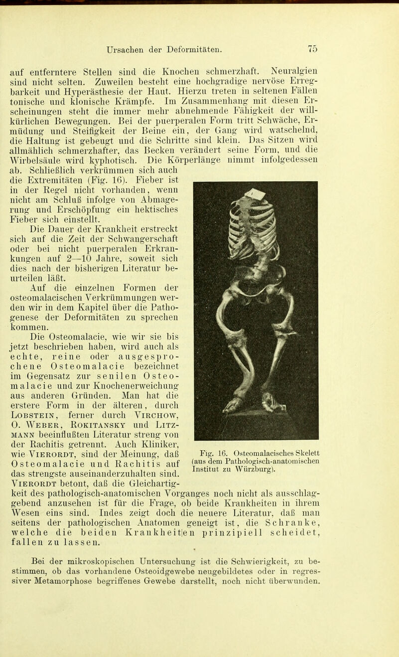 auf entferntere Stelleu sind die Knochen schmerzhaft. Neuralgien sind nicht selten. Zuweilen besteht eine hochgradige nervöse Erreg- barkeit und Hyperästhesie der Haut. Hierzu treten in seltenen Fällen tonische und klonische Krämpfe. Im Zusammenliang mit diesen Er- scheinungen steht die immer mehr abnehmende Fähigkeit der will- kürlichen Bewegungen. Bei der puerperalen Form tritt Schwäche, Er- müdung und Steifigkeit der Beine ein, der Gang wird watschelnd, die Haltung ist gebeugt und die Schritte sind klein. Das Sitzen wird allmählich schmerzhafter, das Becken verändert seine Form, und die Wirbelsäule wird kyphotisch. Die Körperlänge nimmt infolgedessen ab. Schließlich verkrümmen sich auch die Extremitäten (Fig. 16). Fieber ist in der Regel nicht vorhanden, wenn nicht am Schluß infolge von Abmage- rung und Erschöpfung ein hektisches Fieber sich einstellt. Die Dauer der Krankheit erstreckt sich auf die Zeit der Schwangerschaft oder bei nicht puerperalen Erkran- kungen auf 2—10 Jahre, soweit sich dies nach der bisherigen Literatur be- urteilen läßt. Auf die einzelnen Formen der osteomalacischen Verkrümmungen wer- den wir in dem Kapitel über die Patho- genese der Deformitäten zu sprechen kommen. Die Osteomalacie, wie wir sie bis jetzt beschrieben haben, wird auch als echte, reine oder ausgespro- chene Osteomalacie bezeichnet im Gegensatz zur senilen Osteo- malacie und zur Knochenerweichung aus anderen Gründen. Man hat die erstere Form in der älteren, durch Lobstein, ferner durch Virchow, 0. Weber, Rokitansky und Litz- mann beeinflußten Literatur streng von der Rachitis getrennt. Auch Kliniker, wie ViERORDT, sind der Meinung, daß Osteomalacie und Rachitis auf das strengste auseinanderzuhalten sind. ViERORDT betont, daß die Gleichartig- keit des pathologisch-anatomischen Vorganges noch nicht als ausschlag- gebend anzusehen ist für die Frage, ob Ijeide Krankheiten in ihrem Wesen eins sind. Indes zeigt doch die neuere Literatur, daß man seitens der pathologischen Anatomen geneigt ist, die Schranke, welche die beiden Krankheitlen prinzipiell scheidet, fallen zu lassen. Fig. 16. Osteomalacisches Skelett (aus dem Pathologisch-anatomischen Institut zu Würzburg). Bei der mikroskopischen Untersuchung ist die Schwierigkeit, zu be- stimmen, ob das vorhandene Osteoidgewebe neugebildetes oder in regres- siver Metamorphose begriifenes Gewebe darstellt, noch nicht überwunden.