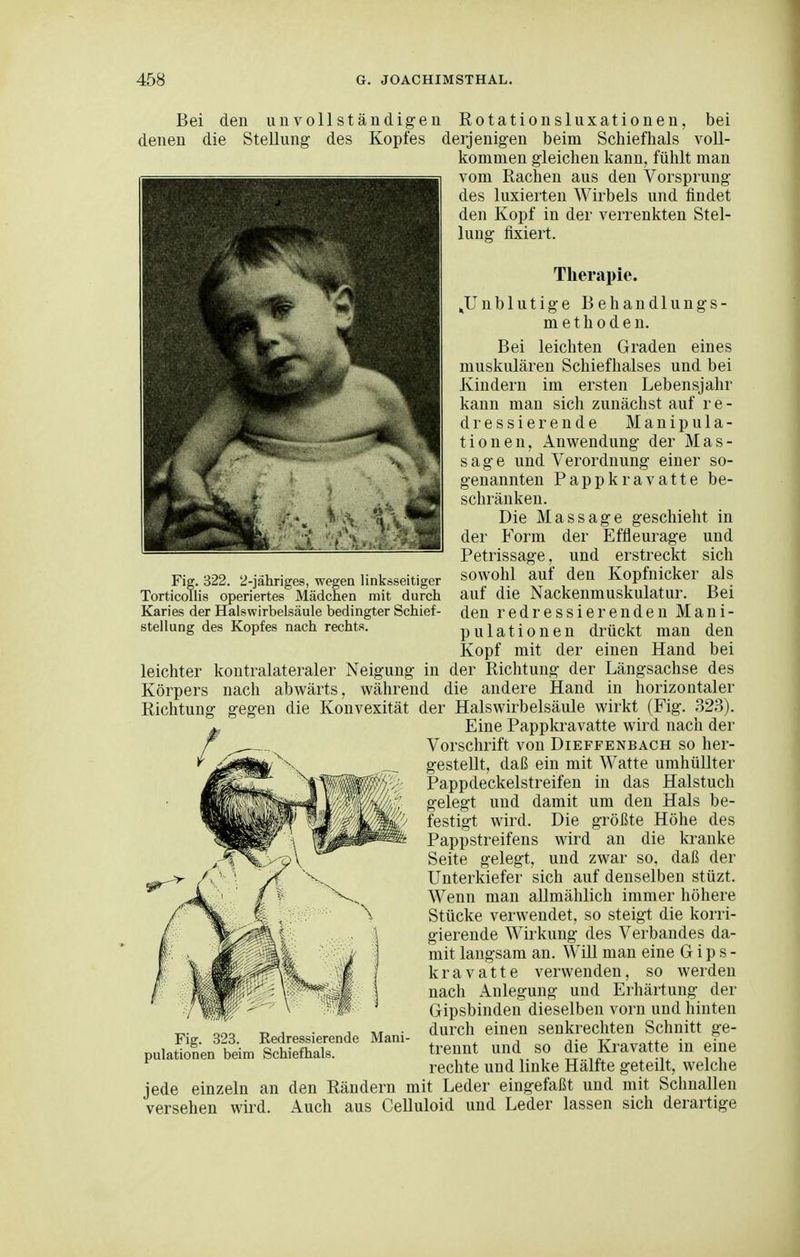 Bei den unvollständigen Rotationsluxationen, bei denen die Stellung des Kopfes derjenigen beim Schief hals voU- kommen gleichen kann, fühlt man vom Rachen aus den Vorsprung des luxierten Wirbels und findet den Kopf in der verrenkten Stel- lung fixiert. Therapie. ^Unblutige Behandlungs- methoden. Bei leichten Graden eines muskulären Schiefhalses und bei Kindern im ersten Lebensjahr kann man sich zunächst auf r e - dressierende Manipula- tionen, Anwendung der Mas- sage und Verordnung einer so- genannten Pappkravatte be- schränken. Die Massage geschieht in der Form der Effleurage und Petrissage, und erstreckt sich Fig. 322. 2-iähriges, wegen linksseitiger sowohl auf den Kopfnicker als TorticoUis operiertes Mädchen mit durch auf die Nackenmuskulatur. Bei Karies der Halswirbelsäule bedingter Schief- den redressierenden Mani- stellung des Kopfes nach rechts. pulationen drückt man den Kopf mit der einen Hand bei leichter kontralateraler Neigung in der Richtung der Längsachse des Körpers nach abwärts, während die andere Hand in horizontaler Richtung gegen die Konvexität der Halswirbelsäule wirkt (Fig. 323). Eine Pappkravatte wird nach der Vorschrift von Dieffenbach so her- gestellt, daß ein mit Watte umhüUter Pappdeckelstreifen in das Halstuch gelegt und damit um den Hals be- festigt wird. Die größte Höhe des Pappstreifens wird an die kranke Seite gelegt, und zwar so, daß der Unterkiefer sich auf denselben stüzt. Wenn man allmählich immer höhere Stücke verwendet, so steigt die korri- gierende Wirkung des Verbandes da- mit langsam an. Will man eine G i p s - kravatte verwenden, so werden nach Anlegung und Erhärtung der Gipsbinden dieselben vorn und hinten durch einen senkrechten Schnitt ge- trennt und so die Kravatte in eine rechte und linke Hälfte geteilt, welche jede einzeln an den Rändern mit Leder eingefaßt und mit Schnallen versehen wird. Auch aus Celluloid und Leder lassen sich derartige Fig. 323. Redressierende Mani- pulationen beim Schiefhals.