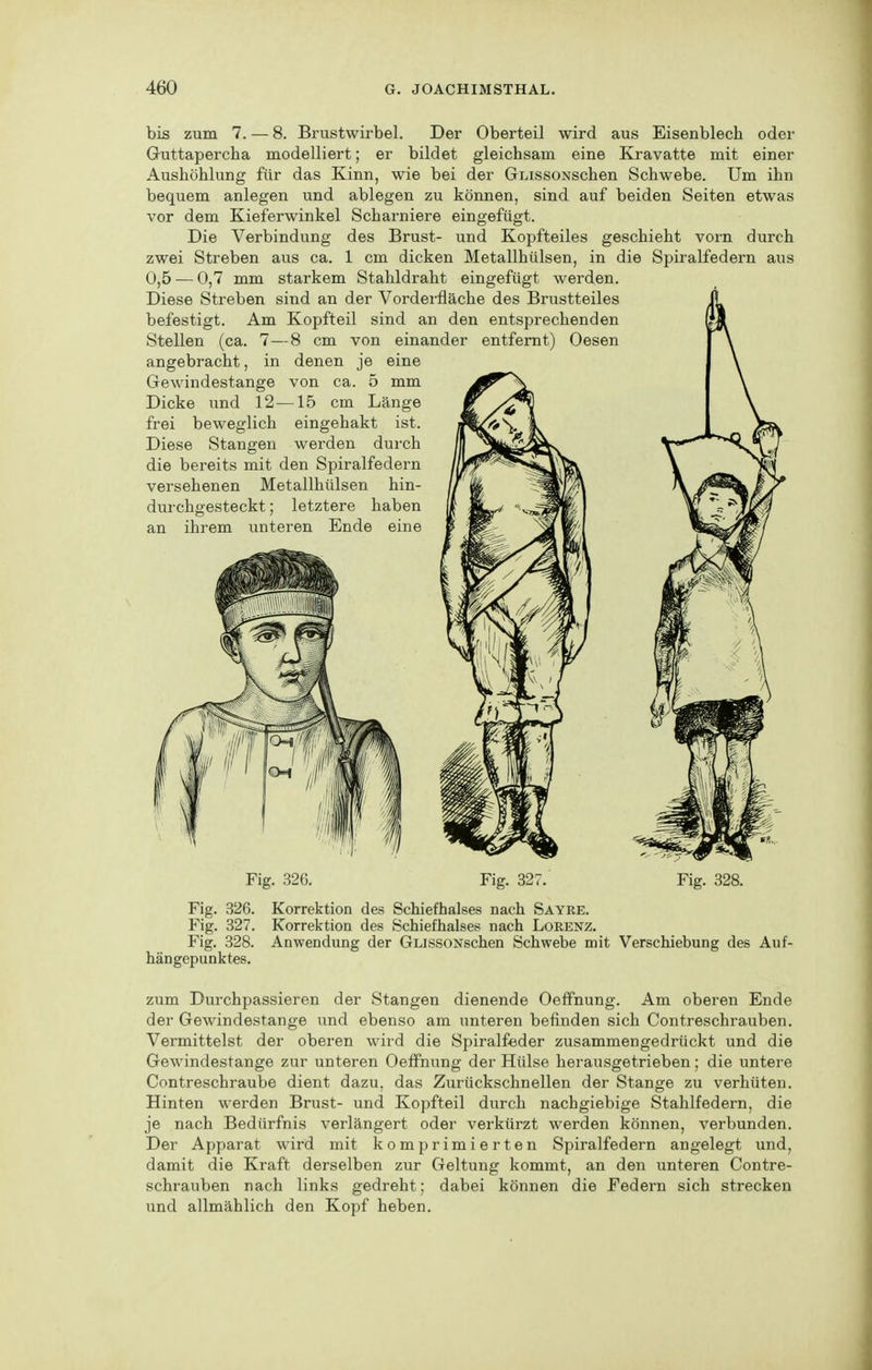 bis zum 7. — 8. Brustwirbel. Der Oberteil wird aus Eisenblech oder Guttapercha modelliert; er bildet gleichsam eine Kravatte mit einer Aushöhlung für das Kinn, wie bei der GLissoNschen Schwebe. Um ihn bequem anlegen und ablegen zu können, sind auf beiden Seiten etwas vor dem Kieferwinkel Scharniere eingefügt. Die Verbindung des Brust- und Kopfteiles geschieht vorn durch zwei Streben aus ca. 1 cm dicken Metallhülsen, in die Spiralfedern aus 0,5 — 0,7 mm starkem Stahldraht eingefügt werden. Diese Streben sind an der Vorderfläche des Brustteiles befestigt. Am Kopfteil sind an den entsprechenden Stellen (ca. 7—8 cm von einander entfernt) Oesen angebracht, in denen je eine Gewindestange von ca. 5 mm Dicke und 12—15 cm Länge frei beweglich eingehakt ist. Diese Stangen werden durch die bereits mit den Spiralfedern versehenen Metallhülsen hin- durchgesteckt ; letztere haben an ihrem unteren Ende eine Fig. 326. Fig. 32^ Fig. 328. Fig. 326. Fig. 327. Fig. 328. hängepunktes. Korrektion des Schiefhalses nach Sayre. Korrektion des Schiefhalses nach Lorenz. Anwendung der GLissoNschen Schwebe mit Verschiebung des Aiif- zum Durchpassieren der Stangen dienende Oeffnung. Am oberen Ende der Gewindestange und ebenso am unteren befinden sich Contreschrauben. Vermittelst der oberen wird die Spiralfeder zusammengedrückt und die Gewindestange zur unteren Oeffnung der Hülse herausgetrieben; die untere Contreschraube dient dazu, das Zurückschnellen der Stange zu verhüten. Hinten werden Brust- und Kopfteil durch nachgiebige Stahlfedern, die je nach Bedürfnis verlängert oder verkürzt werden können, verbunden. Der Apparat wird mit komprimierten Spiralfedern angelegt und, damit die Kraft derselben zur Geltung kommt, an den unteren Contre- schrauben nach links gedreht; dabei können die Federn sich strecken und allmählich den Kopf heben.