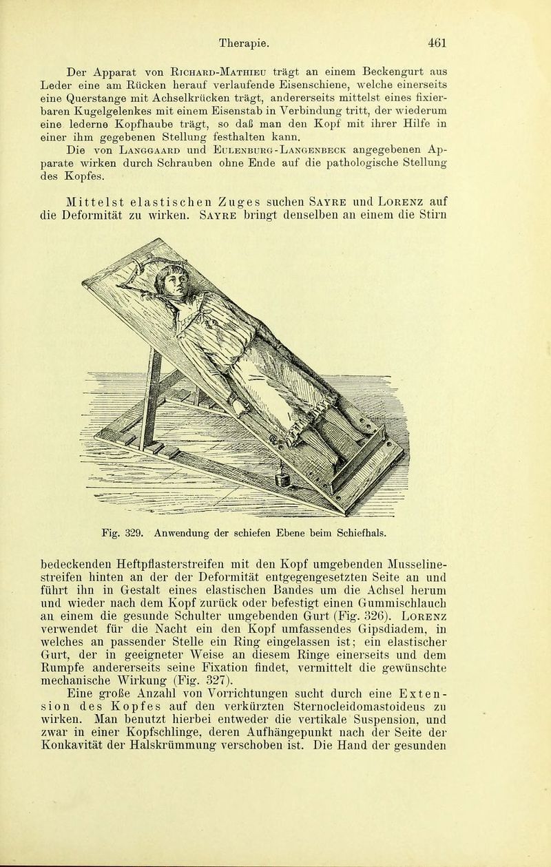 Der Apparat von Richard-Mathibu trägt an einem Beckengurt aus Leder eine am Rücken herauf verlaufende Eisenschiene, welche einerseits eine Querstange mit Achselkrücken trägt, andererseits mittelst eines lixier- baren Kugelgelenkes mit einem Eisenstab in Verbindung tritt, der wiederum eine lederne Kopfhaube trägt, so daß man den Kopf mit ihrer Hilfe in einer ihm gegebenen Stellung festhalten kann. Die von Langgaard und Eulenburg-Langenbbck angegebenen Ap- parate wirken durch Schrauben ohne Ende auf die pathologische Stellung des Kopfes. Mittelst elastischen Zuges suchen Sayre und Lorenz auf die Deformität zu wirken. Sayre bringt denselben an einem die Stirn Fig. 329. Anwendung der schiefen Ebene beim Schiefhals. bedeckenden Heftpflasterstreifen mit den Kopf umgebenden Musseline- streifen hinten an der der Deformität entgegengesetzten Seite an und führt ihn in Gestalt eines elastischen Bandes um die Achsel herum und wieder nach dem Kopf zurück oder befestigt einen Gummischlaucb an einem die gesunde Schulter umgebenden Gurt (Fig. 326). Lorenz verwendet für die Nacht ein den Kopf umfassendes Gipsdiadem, in welches an passender Stelle ein Ring eingelassen ist; ein elastischer Gurt, der in geeigneter Weise an diesem Ringe einerseits und dem Rumpfe andererseits seine Fixation findet, vermittelt die gewünschte mechanische Wirkung (Fig. 327). Eine große Anzahl von Vorrichtungen sucht durch eine Exten- sion des Kopfes auf den verkürzten Sternocleidomastoideus zu wirken. Man benutzt hierbei entweder die vertikale Suspension, und zwar in einer Kopfschlinge, deren Aufhängepunkt nach der Seite der Konkavität der Halskrümmung verschoben ist. Die Hand der gesunden