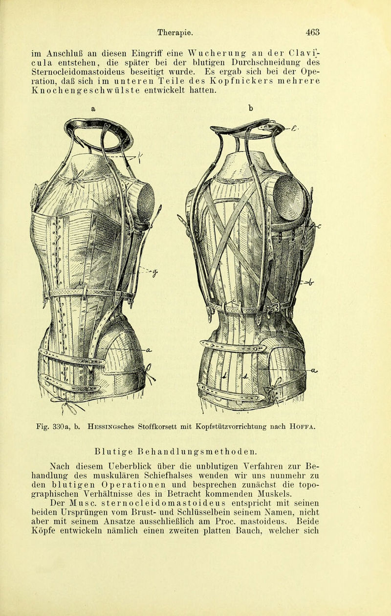 im Anschluß an diesen Eingriff eine Wucherung an der Clavi'- cula entstehen, die später bei der blutigen Durchschneidung des Sternocleidomastoideus beseitigt wurde. Es ergab sich bei der Ope- ration, daß sich im unteren Teile des Kopfnickers mehrere Knochengeschwülste entwickelt hatten. Fig. 330 a, b. HESSiNGsches Stoffkorsett mit Kopf Stützvorrichtung nach Hoffa. Blutige Behandlungsmethoden. Nach diesem Ueberblick über die unblutigen Verfahren zur Be- handlung des muskulären Schiefhalses wenden wir uns nunmehr zu den blutigen Operationen und besprechen zunächst die topo- graphischen Verhältnisse des in Betracht kommenden Muskels. Der Muse, sternocleidomastoideus entspricht mit seinen beiden Ursprüngen vom Brust- und Schlüsselbein seinem Namen, nicht aber mit seinem Ansätze ausschließlich am Proc. mastoideus. Beide Köpfe entwickeln nämlich einen zweiten platten Bauch, welcher sich