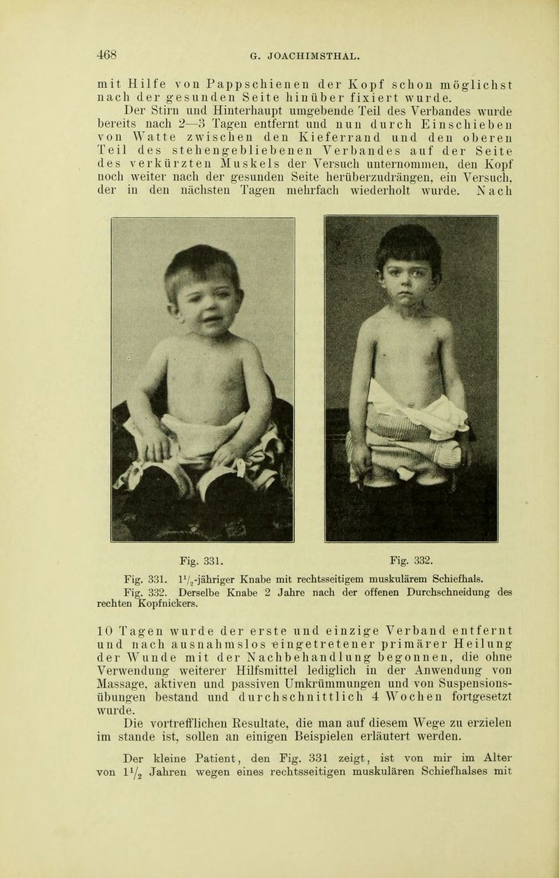 mit Hilfe von Pappschienen der Kopf schon möglichst nach der gesunden Seite hinüber fixiert wurde. Der Stirn und Hinterhaupt umgebende Teil des Verbandes wurde bereits nach 2—3 Tagen entfernt und nun durch Einschieben von Watte zwischen den Kieferrand und den oberen Teil des stehengebliebeneu Verbandes auf der Seite des verkürzten Muskels der Versuch unternommen, den Kopf noch weiter nach der gesunden Seite herüberzudrängen, ein Versuch, der in den nächsten Tagen mehrfach wiederholt wurde. Nach Fig. 331. Fig. 332. Fig. 331. P/.,-jähriger Knabe mit rechtsseitigem muskulärem Schiefhals. Fig. 332. Derselbe Knabe 2 Jahre nach der offenen Durchschneidung des rechten Kopfnickers. 10 Tagen wurde der erste und einzige Verband entfernt und nach ausnahmslos eingetretener primärer Heilung der Wunde mit der Nachbehandlung begonnen, die ohne Verwendung weiterer Hilfsmittel lediglich in der Anwendung von Massage, aktiven und passiven ümkrümmungen und von Suspensions- übungen bestand und durchschnittlich 4 Wochen fortgesetzt wurde. Die vortrefflichen Resultate, die man auf diesem Wege zu erzielen im Stande ist, sollen an einigen Beispielen erläutert werden. Der kleine Patient, den Fig. 331 zeigt, ist von mir im Alter von IY2 Jahren wegen eines rechtsseitigen muskulären Schiefhalses mit
