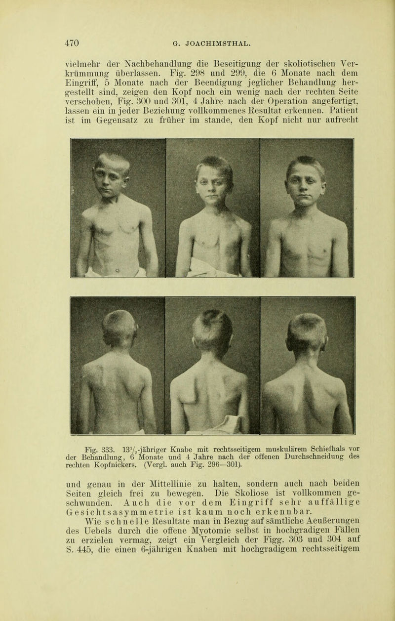 vielmehr der Nachbehaudlung die Beseitigung der skoliotischeu Ver- krümmung überlassen. Fig. 298 und 29i), die 6 Monate nach dem Eingriff', 5 Monate nach der Beendigung jeglicher Behandlung her- gestellt sind, zeigen den Kopf noch ein wenig nach der rechten Seite verschoben, Fig. 300 und 301, 4 Jahre nach der Operation angefertigt, lassen ein in jeder Beziehung vollkommenes Resultat erkennen. Patient ist im Gegensatz zu frülier im stände, den Kopf nicht nur aufreclit Fig. 333. 13 Vj-jähriger Knabe mit rechtsseitigem musliulärem Schiefhals vor der Behandlung, 6 Monate und 4 Jahre nach der offenen Durchschneidung des rechten Kopfnickers. (Vergl. auch Fig. 296—301). und genau in der Mittellinie zu halten, sondern auch nach beiden Seiten gleich frei zu bevi^egen. Die Skoliose ist vollkommen ge- schwunden. Auch die vor dem Eingriff sehr auffällige Gesichtsasymmetrie ist kaum noch erkennbar. Wie schnelle Resultate man in Bezug auf sämtliche Aeußerungen des Uebels durch die offene Mj'otomie selbst in hochgradigen Fällen zu erzielen vermag, zeigt ein Vergleich der Figg. 303 und 304 auf S. 445, die einen 6-jährigen Knaben mit hochgradigem rechtsseitigem