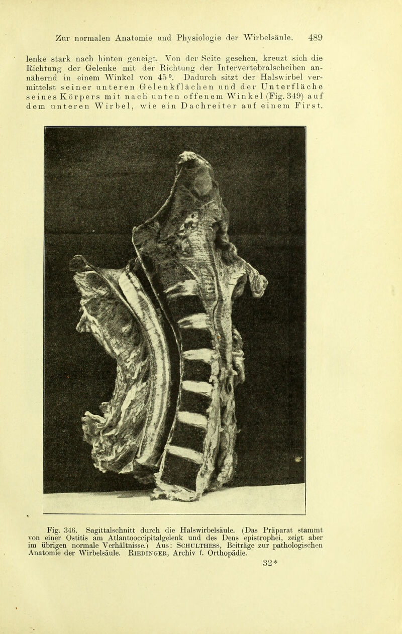 lenke stark nach hinten geneigt. Von der Seite gesehen, kreuzt sich die ßichtuno- der Gelenke mit der Richtung der Intervertebralscheiben an- nähernd in einem Winkel von 45Dadurch sitzt der Halswirbel ver- mittelst seiner unteren Gelenkflächen und der Unter fläche seines Körpers mit nach unten offenem Winkel (Fig. 349) auf dem unteren Wirbel, wie ein Dachreiter auf einem First. Fig. 346. Sagittalschiiitt durch die Halswirbelsäule. (Das Präparat stammt von einer Ostitis am Atlantooccipitalgelenk und des Dens epistrophei, zeigt aber im übrigen normale Verhältnisse.) Aus: Schulthess, Beiträge zur pathologischen Anatomie der Wirbelsäule. Eiedinger, Archiv f. Orthopädie. 32*