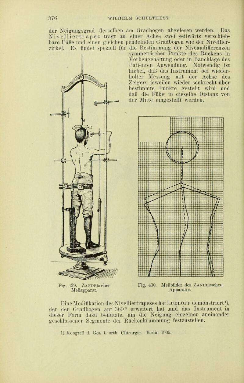 der Neigung-sgrad derselben am Gradbogen abgelesen werden. Das Nivelliertrapez trägt an einer Achse zwei seitwärts verschieb- bare Füße und einen gleichen pendelnden Gradbogen wie der NiveDier- zirkel. Es findet speziell für die Bestimmung der Niveaudifferenzen symmetrischer Punkte des Rückens in Vorbeugehaltung oder in Bauchlage des Patienten Anwendung. Notwendig ist hiebei, daß das Instrument bei wieder- holter Messung mit der Achse des Zeigers je weilen wieder senkrecht über bestimmte Punkte gestellt wird und daß die Füße in dieselbe Distanz von der Mitte eingestellt werden. Fig. 429. ZANDERscher Meßapparat. Fig. 430. Meßbilder des ZANDERschen Apparates. Eine Modifikation des Nivelliertrapezes hatLuDLOFP demonstriert i), der den Gradbogen auf 360 erweitert hat .und das Instrument in dieser Form dazu benutzte, um die Neigung einzelner aneinander geschlossener Segmente der Rückenkrünimung festzustellen. 1) Kongreß d. Ges. f. orth. Chirurgie. Berlin 1905.