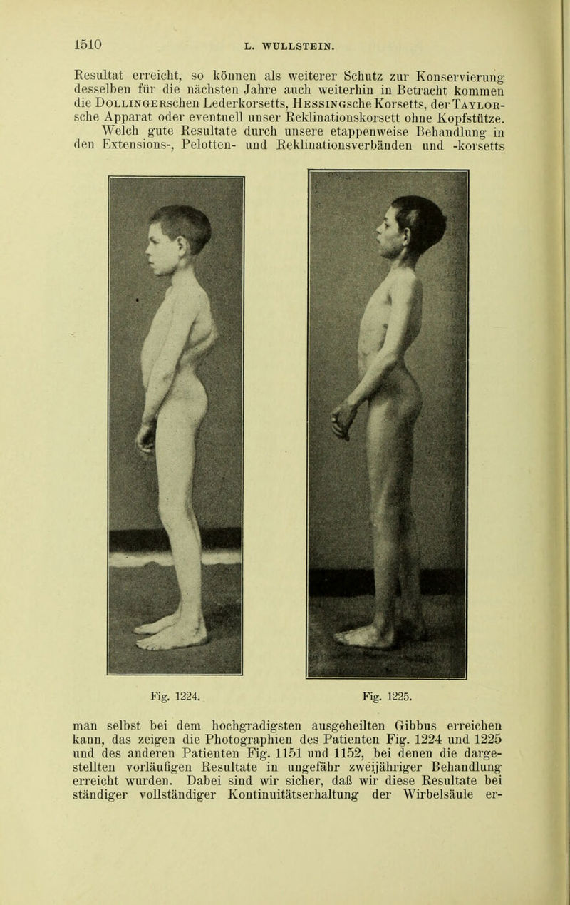 Resultat erreicht, so können als weiterer Schutz zur Konservierung- desselben für die nächsten Jahre auch weiterhin in Betracht kommen die DoLLiNGERschen Lederkorsetts, HessiNGscheKorsetts, derTAYLOR- sche Apparat oder eventuell unser Eeklinationskorsett oline Kopfstütze. Welch gute Resultate durch unsere etappenweise Behandlung in den Extensions-, Pelotten- und Rekliuationsverbänden und -korsetts Fig. 1224. Fig. 1225. man selbst bei dem hochgradigsten ausgeheilten Gibbus erreichen kann, das zeigen die Photographien des Patienten Fig. 1224 und 1225 und des anderen Patienten Fig. 1151 und 1152, bei denen die darge- stellten vorläufigen Resultate in ungefähr zweijähriger Behandlung erreicht wurden. Dabei sind wir sicher, daß wir diese Resultate bei ständiger vollständiger Kontinuitätserhaltung der Wirbelsäule er-
