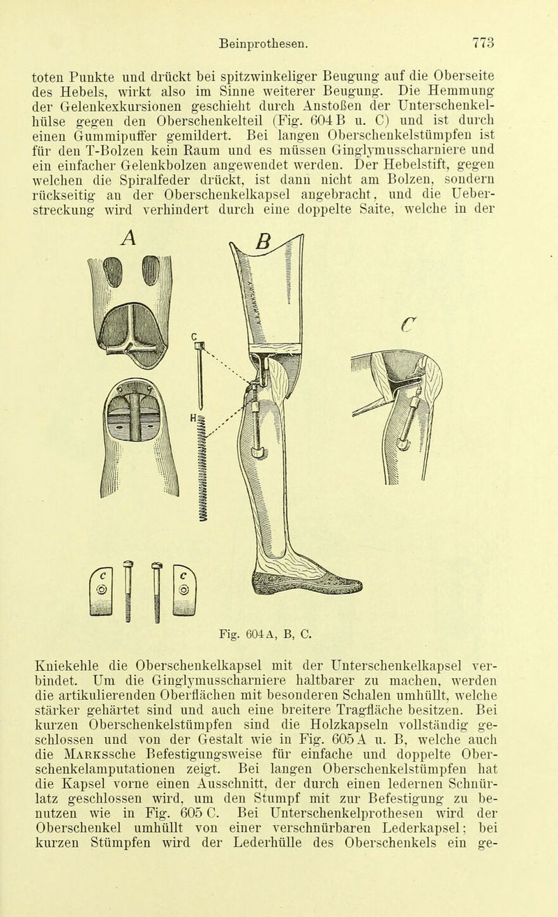 toten Punkte und. drückt bei spitzwinkeliger Beugung auf die Oberseite des Hebels, wirkt also im Sinne weiterer Beugung. Die Hemmung der Gelenkexkursionen geschieht durch Anstoßen der Unterschenkel- hülse gegen den Oberschenkelteil (Fig. 604 B u. C) und ist durch einen Gummipuffer gemildert. Bei langen Oberschenkelstümpfen ist für den T-Bolzen kein Raum und es müssen Ginglymusscharniere und ein einfacher Gelenkbolzen augewendet werden. Der Hebelstift, gegen welchen die Spiralfeder drückt, ist dann nicht am Bolzen, sondern rückseitig an der Oberschenkelkapsel augebracht, und die Ueber- streckung wird verhindert durch eine doppelte Saite, welche in der @ Iii m 1 1 iiii Fig. 604 A, B, C. Kniekehle die Oberschenkelkapsel mit der Unterschenkelkapsel ver- bindet. Um die Ginglymusscharniere haltbarer zu machen, werden die artikulierenden Oberflächen mit besonderen Schalen unihüllt, welche stärker gehärtet sind und auch eine breitere Tragfläche besitzen. Bei kurzen Oberschenkelstümpfen sind die Holzkapseln vollständig ge- schlossen und von der Gestalt wie in Fig. 605 A u. B, welche auch die MARKSsche Befestigungsweise für einfache und doppelte Ober- schenkelamputationen zeigt. Bei langen Oberschenkelstümpfen hat die Kapsel vorne einen Ausschnitt, der durch einen ledernen Schnür- latz geschlossen wird, um den Stumpf mit zur Befestigung zu be- nutzen wie in Fig. 605 C. Bei Unterschenkelprothesen wird der Oberschenkel umhüllt vou einer verschnürbaren Lederkapsel; bei kurzen Stümpfen wird der Leclerhülle des Oberschenkels ein ge-