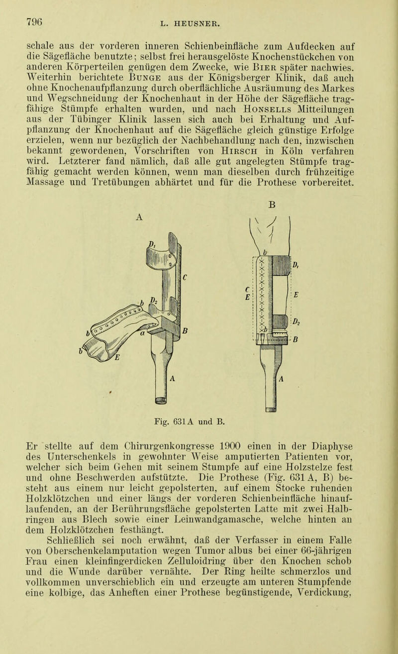 schale aus der vorderen inneren Schienbeinfläche zum Aufdecken auf die Sägefläche benutzte; selbst frei herausgelöste Knochenstückchen von anderen Körperteilen genügen dem Zwecke, wie Bier später nachwies. Weiterhin berichtete Bunge aus der Königsberger Klinik, daß auch ohne Knochenaufpflanzung durch oberflächliche Ausräumung des Markes und Wegschneidung der Knochenhaut in der Höhe der Sägefläche trag- fähige Stümpfe erhalten wurden, und nach Honsells Mitteilungen aus der Tübinger Klinik lassen sich auch bei Erhaltung und Auf- pflanzung der Knochenhaut auf die Sägefläche gleich günstige Erfolge erzielen, wenn nur bezüglich der Nachbehandlung nach den, inzwischen bekannt gewordenen, Vorschriften von Hirsch in Köln verfahren wird. Letzterer fand nämlich, daß alle gut angelegten Stümpfe trag- fähig gemacht werden können, wenn man dieselben durch frühzeitige Massage und Tretübungen abhärtet und für die Prothese vorbereitet. B Fig. 631A und B. Er stellte auf dem Chirurgenkongresse 1900 einen in der Diaphyse des Unterschenkels in gewohnter Weise amputierten Patienten vor, welcher sich beim Gehen mit seinem Stumpfe auf eine Holzstelze fest und ohne Beschwerden aufstützte. Die Prothese (Fig. 631A, B) be- steht aus einem nur leicht gepolsterten, auf einem Stocke ruhenden Holzklötzchen und einer längs der vorderen Schienbeinfläche hinauf- laufenden, an der Berührungsfläche gepolsterten Latte mit zwei Halb- ringen aus Blech sowie einer Leinwandgamasche, welche hinten an dem Holzklötzchen festhängt. Schließlich sei noch erwähnt, daß der Verfasser in einem Falle von Oberschenkelamputation wegen Tumor albus bei einer 66-jährigen Frau einen kleinfingerdicken Zelluloidring über den Knochen schob und die Wunde darüber vernähte. Der Ring heilte schmerzlos und vollkommen unverschieblich ein und erzeugte am unteren Stumpfende eine kolbige, das Anheften einer Prothese begünstigende, Verdickung,