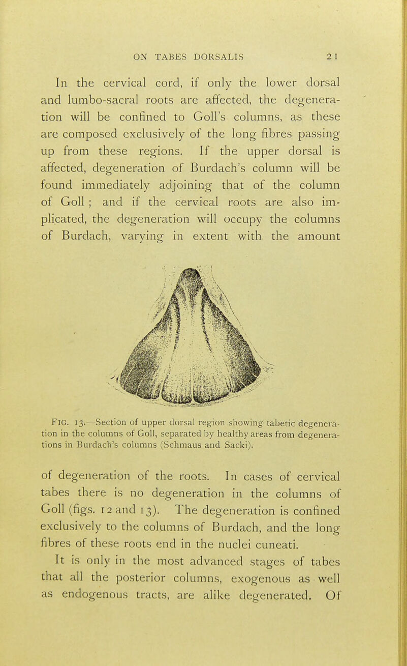 In the cervical cord, if only the lower dorsal and lumbo-sacral roots are affected, the degenera- tion will be confined to Goll's columns, as these are composed exclusively of the long fibres passing up from these regions. If the upper dorsal is affected, degeneration of Burdach's column will be found immediately adjoining that of the column of Goll ; and if the cervical roots are also im- plicated, the degeneration will occupy the columns of Burdach, varying in extent with the amount FiC. 13.—Section of upper dorsal region showing tabetic degenera- tion in the columns of Goll, separated by healthy areas from degenera- tions in Burdach's columns (Schmaus and Sacki). of degeneration of the roots. In cases of cervical tabes there is no degeneration in the columns of Goll (figs. 12 and 13). The degeneration is confined exclusively to the columns of Burdach, and the long fibres of these roots end in the nuclei cuneati. It is only in the most advanced stages of tabes that all the posterior columns, exogenous as well as endogenous tracts, are alike degenerated. Of