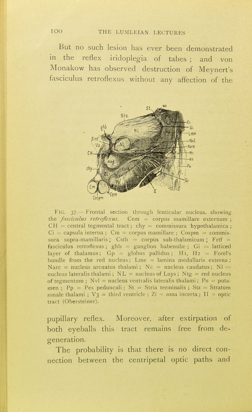 IOO But no such lesion has ever been demonstrated in the reflex iridoplegia of tabes ; and von Monakow has observed destruction of Meynert's fasciculus retroflexus without any affection of the FlG. 37.— Frontal section through lenticular nucleus, showing the fasciculus retroflexus. Cem = corpus mamillare externum ; CH = central tegmental tract; chy = commissura hypothalamica ; Ci = capsula interna ; Cm = corpus mamillare ; Cospm = commis- sura supra-mamillaris; Csth = corpus sub-thalamicum ; Frtf = fasciculus retroflexus; ghb = ganglion habenulae ; Gi — latticed layer of thalamus; Gp = globus pallidus ; Hi, H2 = Forel's bundle from the red nucleus; Lme = lamina medullaris externa ; Narc — nucleus arcuatus thalami; Nc = nucleus caudatus; Nl == nucleus lateralis thalami; NL = nucleus of Luys ; Ntg = red nucleus of tegmentum ; Nvl = nucleus centralis lateralis thalami; Pu = puta- men ; Pp = Pes pedunculi ; St = Stria terminalis ; Stz = Stratum zonalc thalami ; V3 = third ventricle ; Zi = zona incerta ; II = optic tract (Obersteiner). pupillary reflex. Moreover, after extirpation of both eyeballs this tract remains free from de- generation. The probability is that there is no direct con- nection between the centripetal optic paths and