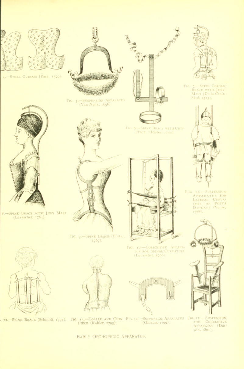 Fig. 9.—Spine Brack (Portal 1767). . 12.—Spin-e Brace (Schmidt, 1794). Fig. 13.—Collar and Chin- Piece (Kohlcr, 1795). Fig. 14.—Suspension Apparatus Fig. 15.—Suspension (Glisson, 1799). and Corrective Apparatus (Dar- win, 1801). early Orthopedic apparatus.