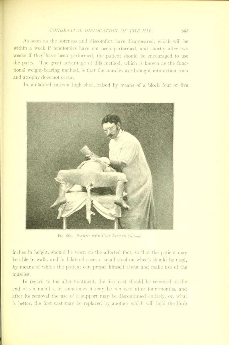 As soon as the soreness and discomfort have disappeared, which will be within a week if tenotomies have not been performed, and shortly after two weeks if they have been performed, the patient should be encouraged to use the parts. The great advantage of this method, which is known as the func- tional weight-bearing method, is that the muscles are brought into action soon and atrophy does not occur. In unilateral cases a high shoe, raised by means of a block four or five Fig. 663.—Patient with Cast Applied (Wilson). inches in height, should be worn on the affected foot, so that the patient may be able to walk, and in bilateral cases a small stool on wheels should be used, by means of which the patient can propel himself about and make use of the muscles. In regard to the after-treatment, the first cast should be removed at the end of six months, or sometimes it may be removed after four months, and after its removal the use of a support may be discontinued entirely, or, what is better, the first cast may be replaced by another which will hold the limb