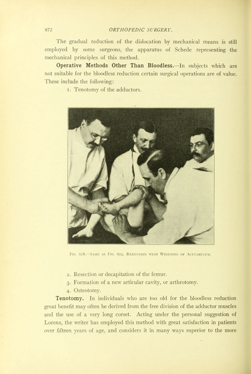 The gradual reduction of the dislocation by mechanical means is still employed by some surgeons, the apparatus of Schede representing the mechanical principles of this method. Operative Methods Other Than Bloodless—In subjects which are not suitable for the bloodless reduction certain surgical operations are of value. These include the following: i. Tenotomy of the adductors. Fig. 676.—Same as Fig. 674; Reduction with Widening of Acetabulum. 2. Resection or decapitation of the femur. 3. Formation of a new articular cavity, or arthrotomy. 4. Osteotomy. Tenotomy. In individuals who are too old for the bloodless reduction great benefit may often be derived from the free division of the adductor muscles and the use of a very long corset. Acting under the personal suggestion of Lorenz, the writer has employed this method with great satisfaction in patients over fifteen years of age, and considers it in many ways superior to the more