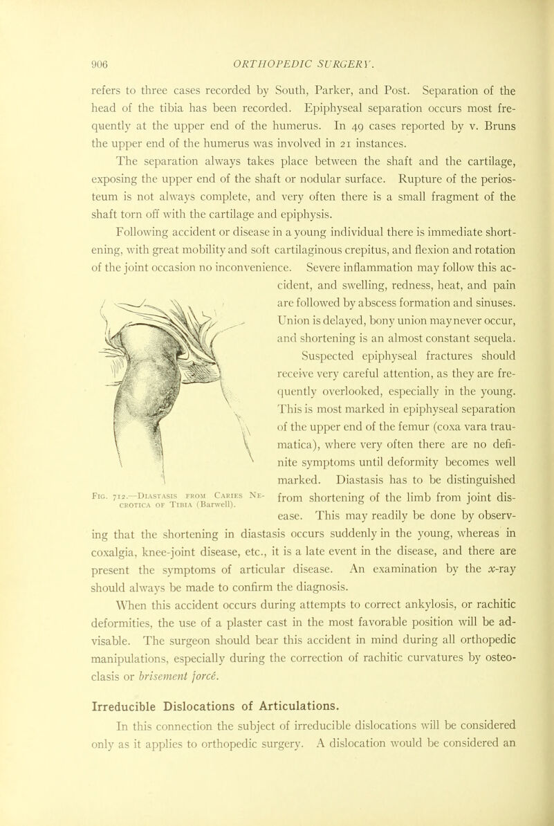 refers to three cases recorded by South, Parker, and Post. Separation of the head of the tibia has been recorded. Epiphyseal separation occurs most fre- quently at the upper end of the humerus. In 49 cases reported by v. Bruns the upper end of the humerus was involved in 21 instances. The separation always takes place between the shaft and the cartilage, exposing the upper end of the shaft or nodular surface. Rupture of the perios- teum is not always complete, and very often there is a small fragment of the shaft torn off with the cartilage and epiphysis. Following accident or disease in a young individual there is immediate short- ening, with great mobility and soft cartilaginous crepitus, and flexion and rotation of the joint occasion no inconvenience. Severe inflammation may follow this ac- cident, and swelling, redness, heat, and pain are followed by abscess formation and sinuses. Union is delayed, bony union may never occur, and shortening is an almost constant sequela. Suspected epiphyseal fractures should arrive very careful attention, as they are fre- quently overlooked, especially in the young. This is most marked in epiphyseal separation of the upper end of the femur (coxa vara trau- matica), where very often there are no defi- nite symptoms until deformity becomes well marked. Diastasis has to be distinguished from shortening of the limb from joint dis- ease. This may readily be done by observ- ing that the shortening in diastasis occurs suddenly in the young, whereas in coxalgia, knee-joint disease, etc., it is a late event in the disease, and there are present the symptoms of articular disease. An examination by the #-ray should always be made to confirm the diagnosis. When this accident occurs during attempts to correct ankylosis, or rachitic deformities, the use of a plaster cast in the most favorable position will be ad- visable. The surgeon should bear this accident in mind during all orthopedic manipulations, especially during the correction of rachitic curvatures by osteo- clasis or brisement force. Fig. 712.—Diastasis from Caries Ne crotica of Tibia (Barwell). Irreducible Dislocations of Articulations. In this connection the subject of irreducible dislocations will be considered only as it applies to orthopedic surgery. A dislocation would be considered an