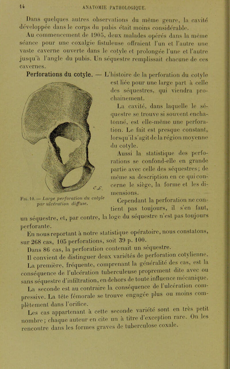 cavil<5 Dans quelques autres observntions du même genre, la développée dans le corps du pubis était moins considérable. Au conmiencement de tDOo, deux malades opérés dans la njémc séanc(^ pour une coxalgie fistuleuse olIVaient l'un et l'autre une vaste caverne ouverte dans le cqtyle et prolong(ie l'une et l'autre jusqu'à l'angle du pubis. Un séquestre remplissait cbacune de ces cavernes. Perforations du cotyle. — L'bistoire de la perforation du colyle est liée pour une large part à ceUe des séquestres, qui viendra pro- chainement. La cavité, dans laquelle le sé- (juestre se trouve si souvent encba- tonné, est elle-même une perfora- tion. Le fait est presque constant, lorsqu'il s'agit de la région moyenne du cotyle. Aussi la statistique des perfo- rations se confond-elle en grande partie avec celle des séquestres ; de même sa description en ce qui con cerne le siège, la forme et les di- FiG. lO.— Large perforation du cotyle par ulcération diffuse. mensions. Cependant la perforation ne con- tient pas toujours, il s'en faut, un séquestre, et, par contre, la loge du séquestre n'est pas toujours perforante. En nous reportant à notre statistique opératoire, nous constatons, sur 268 cas, 105 perforations, soit 39 p. 100. Dans 86 cas, la perforation contenait un séquestre. Il convient de distinguer deux variétés de perforation cotylienne. La première, fréquente, comprenant la généralité des cas, est la conséquence de l'ulcération tuberculeuse proprement dite avec ou sans séquestre d'infiltration, en dehors de toute influence mécamque. La seconde est au contraire la conséquence de l'ulcération coni- pressive. La tête fémorale se trouve engagée plus ou moins com- plètement dans l'orifice. ^ Les cas appartenant à cette seconde variété sont en très petit nombre; chaque auteur en cite un à titre d'exception rare. On les rencontre dans les formes graves de tuberculose coxale.