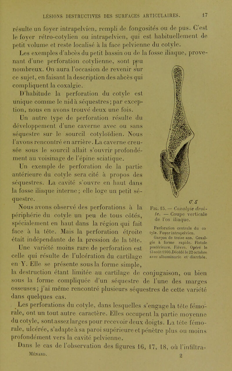 résulte un foyer intrapclvien, rempli de fongosite's ou de pus. C'est le foyer rélro-cotylien ou intrapelvien, qui est habituellement de petit volume et reste localisé à la face pelvienne du cotyle. Les exemples d'abcès du petit bassin ou de la fosse ilia(jue, prove- nant d'une perforation cotyhennc, sont pjeu nombreux. On aura l'occasion de revenir sur ce su jet, en faisant la description des abcès qui compliquent la coxalgie. D'habitude la perforation du cotyle est unique comme le nid à séquestres; par excep- tion, nous en avons trouvé deux une fois. Un autre type de perforation résulte du développement d'une caverne avec ou sans séquestre sur le sourcil cotyloïdien. Nous l'avons rencontré en arrière. La caverne creu- sée sous le sourcil allait s'ouvrir profondé- ment au voisinage de l'épine sciatique. Un exemple de perforation de la partie antérieure du cotyle sera cité à propos des séquestres. La cavité s'ouvre en haut dans la fosse iliaque interne ; elle loge un petit sé- questre. Nous avons observé des perforations à la Fig. 15.— Coxalgie droi- périphérie du cotyle un peu de tous côtés, ~ ^'^P'^ verticale , . , ^ 1.11 r • • P • <ie l'os iliaque, spécialement en haut dans la région qui fait P ^^.A, n/r-1 p • r • Perforation centrale du co lace a la tete. Mais la perloration étroite tyie. Foyerinirapeivien. était indépendante de la pression de la\ête. ^Tl^^'X^; Une variété moins rare de perforation est postérieure. Fièvre. Opéré le . , , 1 ij 1 -1 13aoùH900.Décédéle22octobre celle qui resuite de 1 ulcération du cartilage avec albuminurie et diarrhée, en Y. Elle se présente sous la forme simple, la destruction étant limitée au cartilage de conjugaison, ou bien sous la forme compHquée d'un séquestre de l'une des marges osseuses ; j'ai même rencontré plusieurs séquestres de cette variété dans quelques cas. Les perforations du cotyle, dans lesquelles s'engage la tète fémo- rale, ont un tout autre caractère. Elles occupent la partie moyenne du cotyle, sont assez larges pour recevoir deux doigts. La tète fémo- rale, ulcérée, s'adapte à sa paroi supérieure et pénètre plus ou moins profondément vers la cavité pelvienne. Dans le cas de l'observation des figures 16, 17, 18, oiî l'iiifillra- MlÎNAtlU. 2