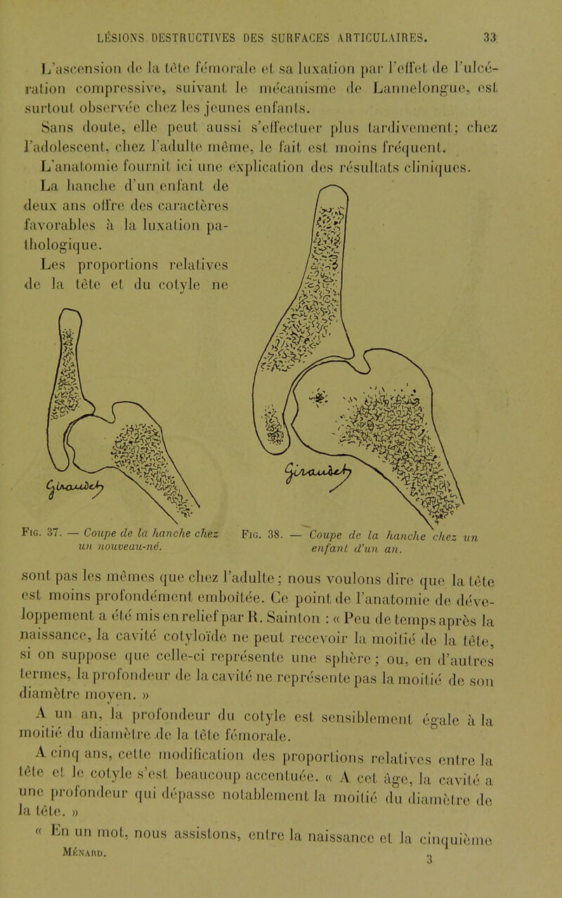 L'ascension de la tote fémorale et sa luxation par l'effet de l'ulcé- ration conipressive, suivant le mécanisme de Lannelongue, est surtout observée chez les jeunes enfants. Sans doute, elle peut aussi s'effectuer plus tardivement; chez l'adolescent, chez l'adulte même, le fait est moins fré(juent. L'anatomie fournit ici une e'xphcation des résultats cliniques. La hanche d'un enfant de deux ans offre des caractères favorables à la luxation pa- thologique. Les proportions relatives de la tète et du cotyle ne FiG. 37. — Coupe de la hanche chez un nouveau-né. FiG. 38. — Coupe de la hanche chez un enfanl d'un an. sont pas les mêmes que chez l'adulte ; nous voulons dire que la tête est moins profondément emboîtée. Ce point de l'anatomie de déve- loppement a été mis en relief par R. Sainton : « Peu de temps après Ui naissance, la cavité cotyloïde ne peut recevoir la moitié de la tête, si on suppose que celle-ci représente une sphère ; ou, en d'autres termes, la profondeur de la cavité ne représente pas la moitié de son diamètre moyen. » A un an, la profondeur du cotyle est sensiblement égale à la moitié du diamètre .de la tête fémorale. A cinq ans, cette modification des proportions relatives entre la tête et le cotyle s'est beaucoup accentuée. « A cet âge, la cavité a une profondeur qui dépasse notablement la moitié du diamètre de la tète, » « En un mot, nous assistons, entre la naissance et la cinquième MÉNAno. 2