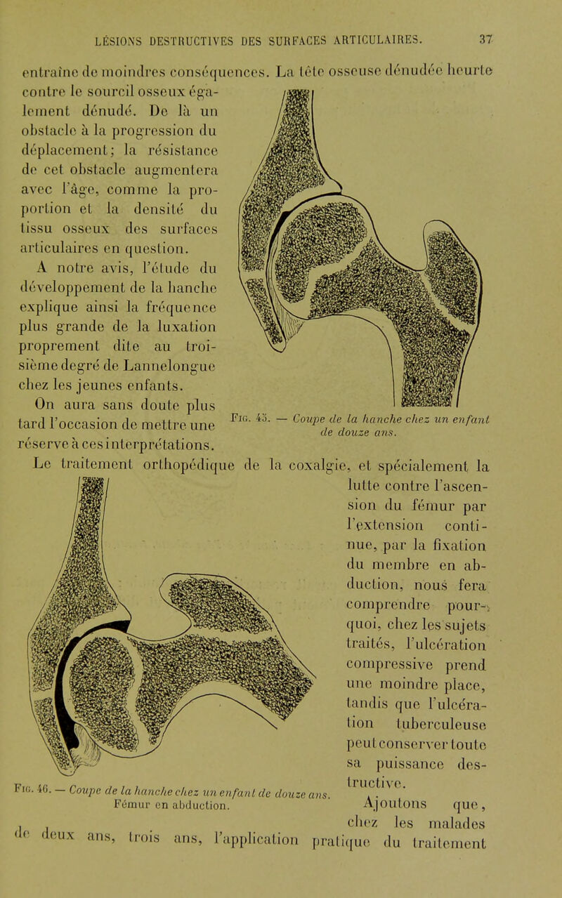 FiG. 43. — Coupe de la hanche chez un enfant de douze ans. entraîne de moindres conséquences. La lêlc osseuse dénudée heurte contre le sourcil osseux éga- lement dénudé. De là un obstacle à la progression du déplacement; la résistance de cet obstacle augmentera avec l'âg-e, comme la pro- portion et la densité du tissu osseux des surfaces articulaires en question. A notre avis, l'étude du développement de la hanche explique ainsi la fréquence plus g-rande de la luxation proprement dite au troi- sième deg'ré de Lannclongue chez les jeunes enfants. On aura sans doute plus tard l'occasion de mettre une réserve à ces interprétations. Le traitement orthopédique de la coxalg-ie, et spécialement la lutte contre l'ascen- sion du fémur par l'extension conti- nue, par la fixation du membre en ab- duction, nous fera comprendre pour-> quoi, chez les sujets traités, l'ulcération compressive prend une moindre place, tandis que l'ulce'ra- tion tuberculeuse peut conserver toute sa puissance des- tructive. Ajoutons que, chez les malades deux ans, trois ans, l'application pratique du traitement Fio. 40. — Coupe de la hanche chez un eiifanl de douze ans. Fémur en abduction. (le