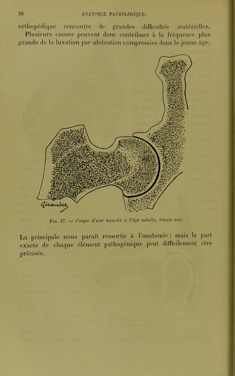 orlliopédiqiie renconlro do grandes difficullés inutériellfs. Plusieurs causes peuvent donc contribuer à la fréquence plus grande de la luxation par ulcération compressive dans le jeune âge. FiG. 47. — Coupe d'une hanche à l'âge adulte, trente ans. La principale nous paraît ressortir à l'anatomie; mais la part exacte de chaque élément pathogénique peut difficilement être précisée.