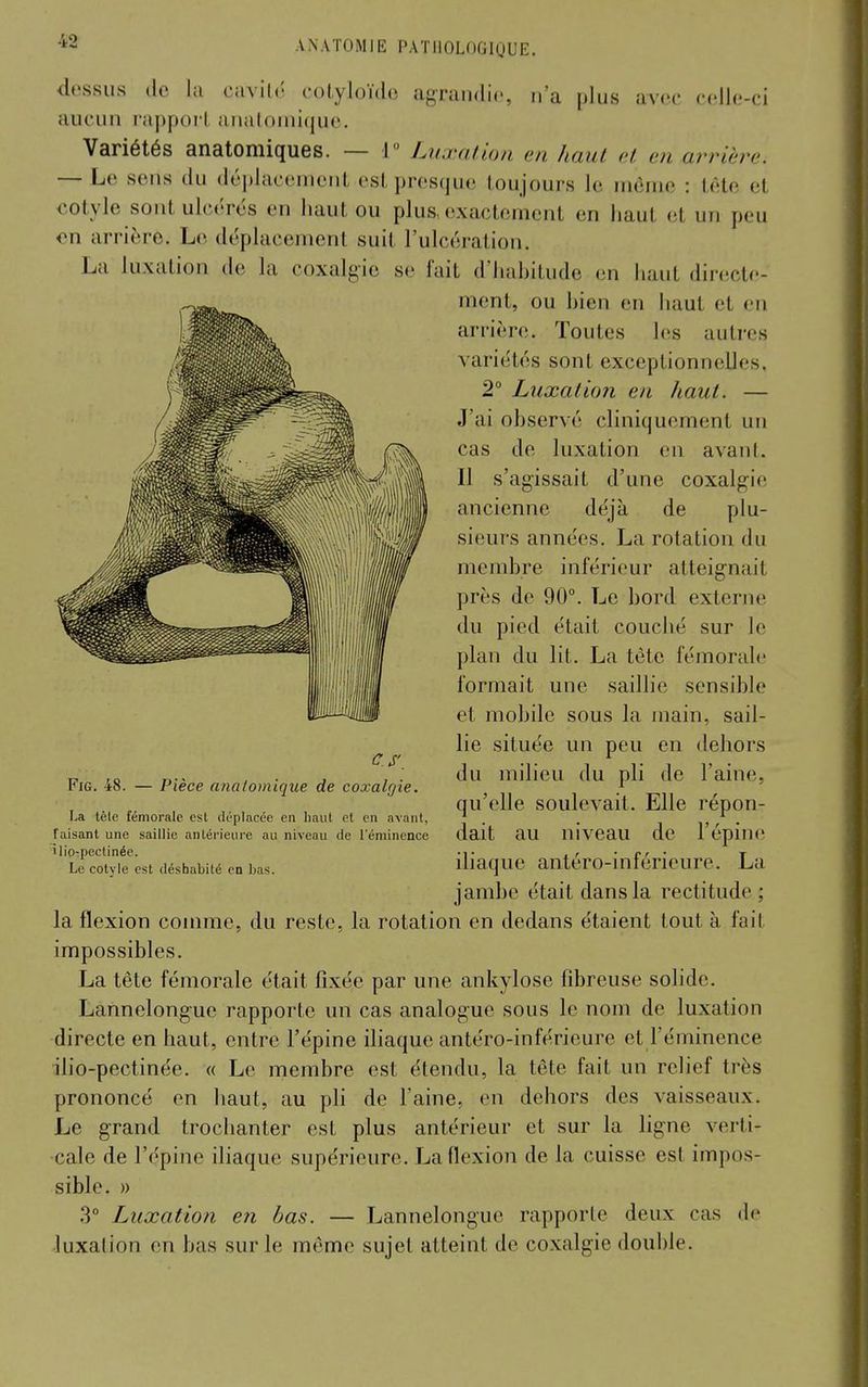 dessus (le la cavito cotyloïdo agrandie, n'a plus avec coJle-ci aucun rappori aiialoiuiquc. Variétés anatomiques. — J Luxation en haut et en arrière. — Le sens du déplacement est presque loujours le même : tète et €0tyie sont ulcérés en haut ou plus, exactement en haut et un peu <?n arrière. Le déplacement suit l'ulcération. La luxation de la coxalgie se fait d'iiahitude en haut dinîcte- ment, ou hien en haut et en arrière. Toutes les autres variétés sont exceptionnelles, 2° Luxation en haut. — J'ai ohservé cliniquement un cas de luxation en avant. Il s'agissait d'une coxalgie ancienne déjà de plu- sieurs années. La rotation du membre inférieur atteignait près de 90°. Le bord externe du pied était couché sur le plan du lit. La tète fémorale formait une saillie sensible et mobile sous la main, sail- lie située un peu en dehors du milieu du pli de l'aine, qu'elle soulevait. Elle répon- dait au niveau de l'épine iliaque antéro-inférieure. La jambe était dans la rectitude; la flexion conuTie, du reste, la rotation en dedans étaient tout à fait impossibles. La tète fémorale était fixée par une ankylose fibreuse solide. Lannelonguc rapporte un cas analogue sous le nom de luxation directe en haut, entre l'épine iliaque antéro-inférieure et l'éminence ilio-pectinée. « Le membre est étendu, la tète fait un relief très prononcé en haut, au pli de l'aine, en dehors des vaisseaux. Le grand trochanter est plus antérieur et sur la ligne verti- cale de l'épine iliaque supérieure. La flexion de la cuisse est impos- sible. » ,3 Luxation en bas. — Lannelonguc rapporte deux cas de luxation en bas sur le môme sujet atteint de coxalgie double. C S' FiG. 48. — Pièce analomique de coxalgie. La tête fémorale est déplacée en haut et en avant, faisant une saillie antéi'ieure au niveau de l'éminence ilio-pectinée. Le cotvle est déshabité en bas.